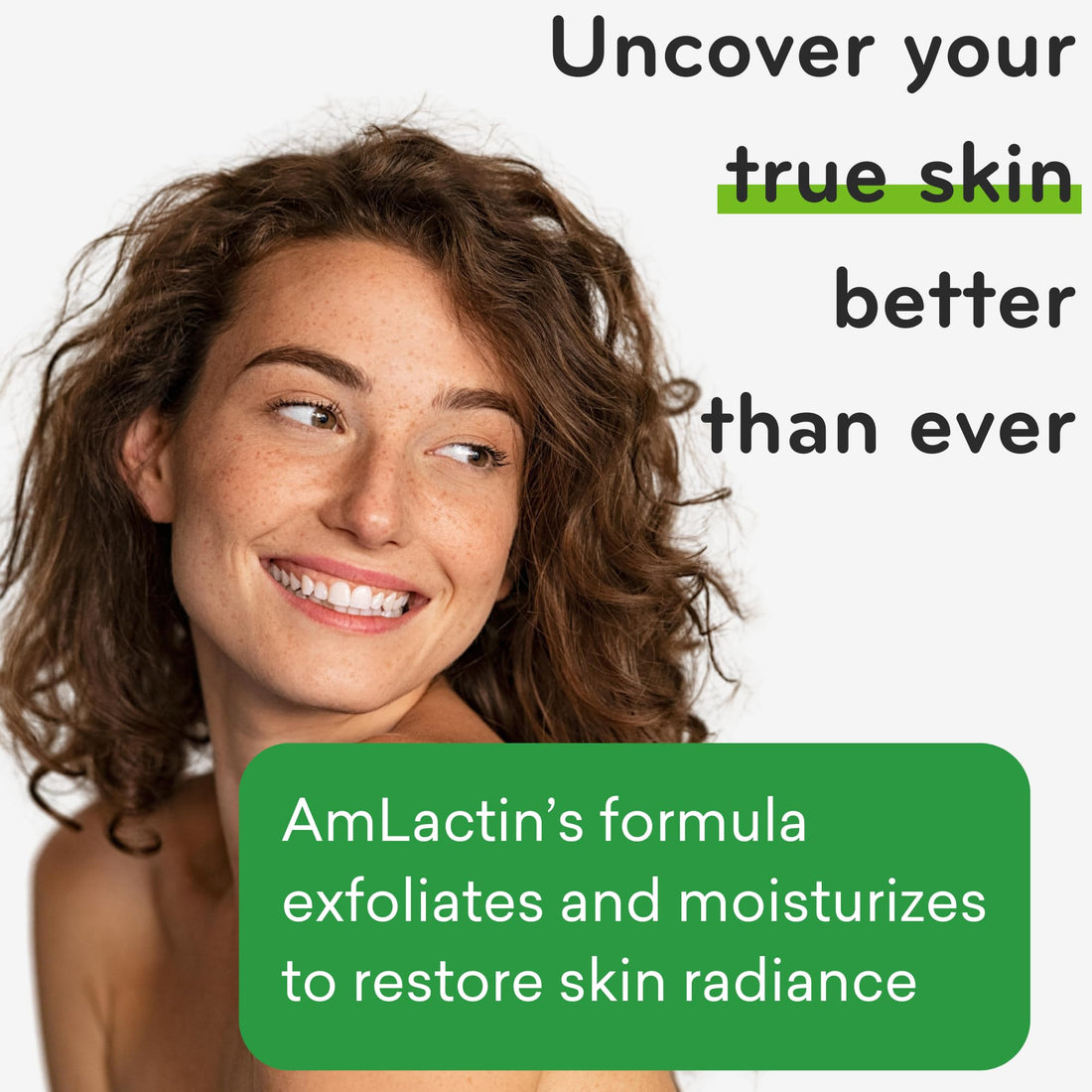 AmLactin Sandoz Daily Moisturizing Body Lotion 12%, 14.1 Ounce