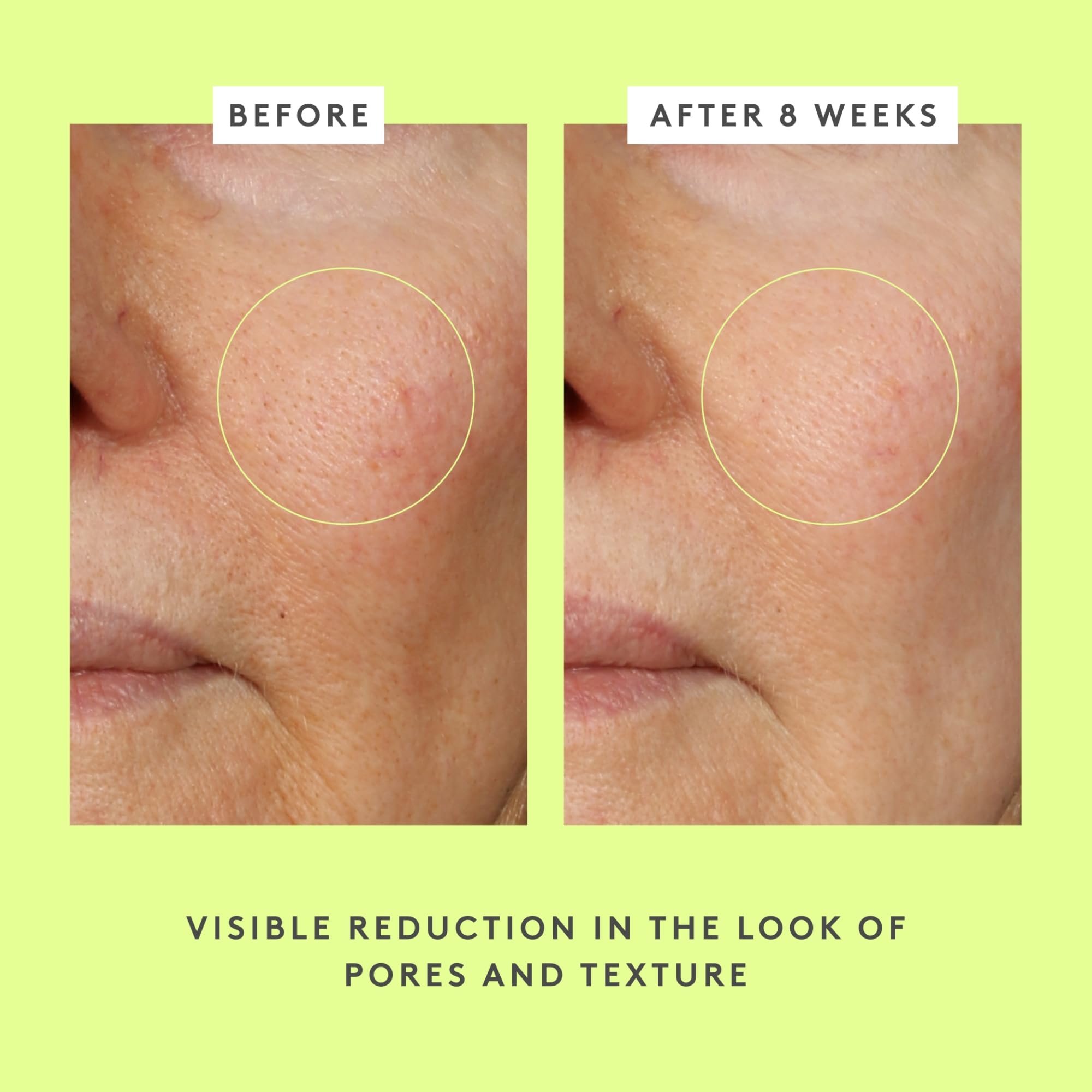 Drunk Elephant T.L.C. Framboos Glycolic Serum - 30 ml/1 fl oz - Exfoliating AHA Serum - Clean Clinical Skincare - Cruelty-Free - Dermatologist-Tested - Free of Essential Oils, Silicones, and Fragrance