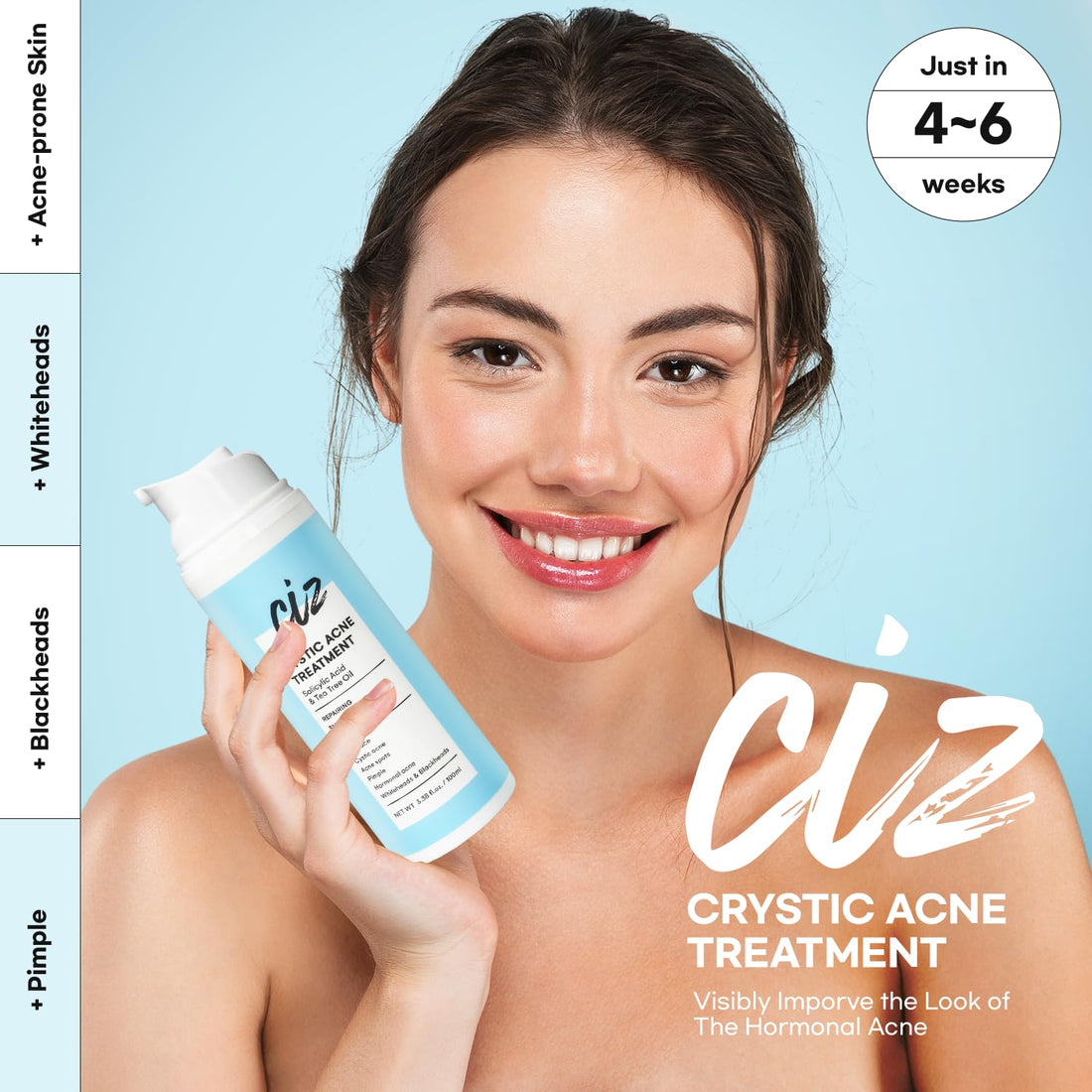 Cystic Acne Spot Treatment for Face: Hormonal Acne Pimple Cream with Salicylic Acid & Tea Tree Oil - Hormonal & Pimple Cream for Teens & Adults,120 Day Supply & 3.38 oz / 100 ml