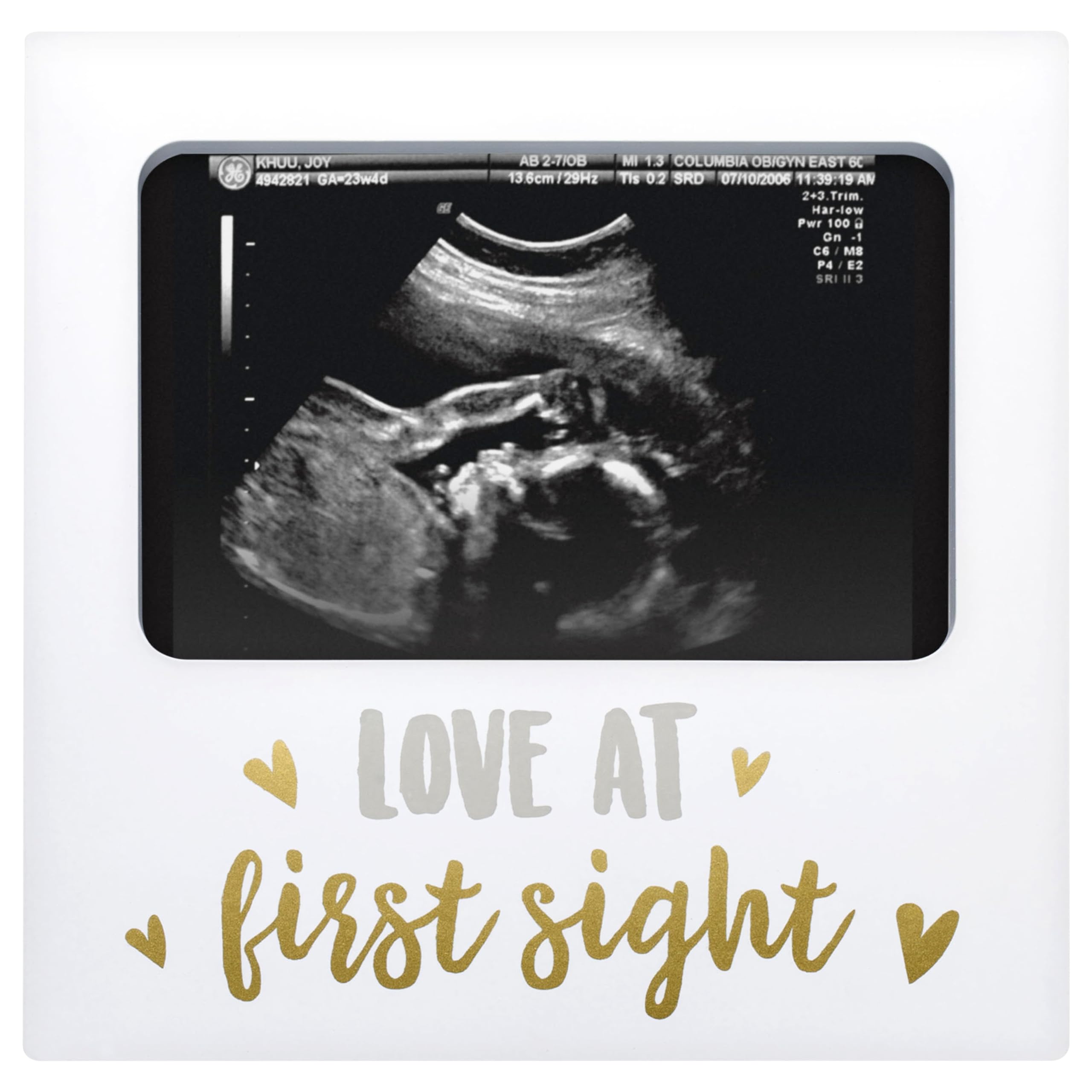 Tiny Ideas Love at First Sight Sonogram Picture Frame, Gender Neutral Ultrasound Keepsake, Ideal Pregnancy Gift, Baby Shower and Nursery Decor, 4” x6” Photo Insert, Gold, Silver And White