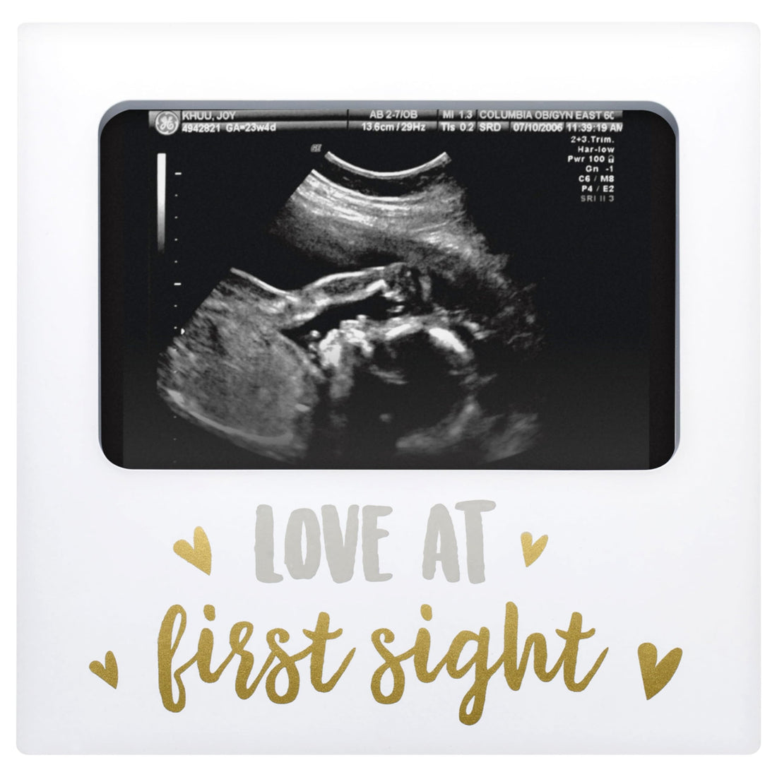 Tiny Ideas Love at First Sight Sonogram Picture Frame, Gender Neutral Ultrasound Keepsake, Ideal Pregnancy Gift, Baby Shower and Nursery Decor, 4” x6” Photo Insert, Gold, Silver And White