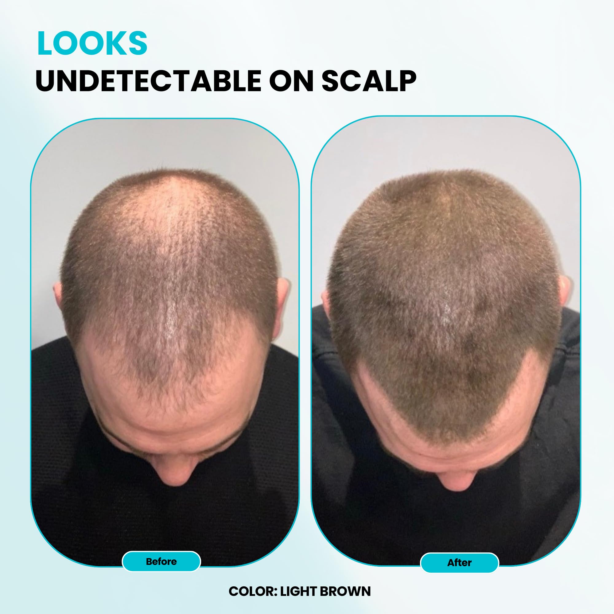 SureThik Hair Thickening Fiber, 100% Organic Keratin Natural Building Fibers, 30 G, Black