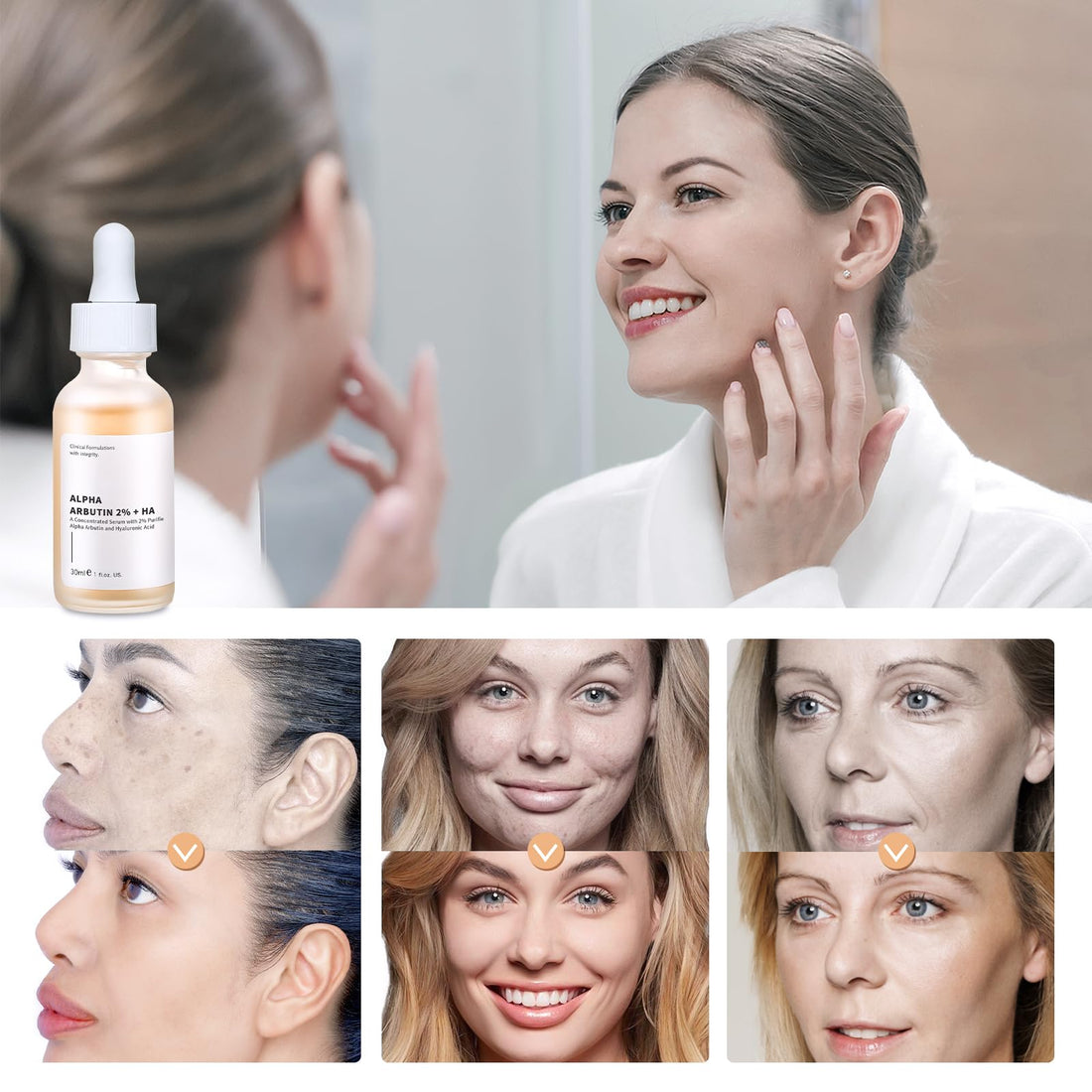 Alpha Arbutin 2% + Hyaluronic Acid Serum for Face, 2PCS Alpha Arbutin Serum for Acne, Fine Lines and Wrinkle for Women & Men