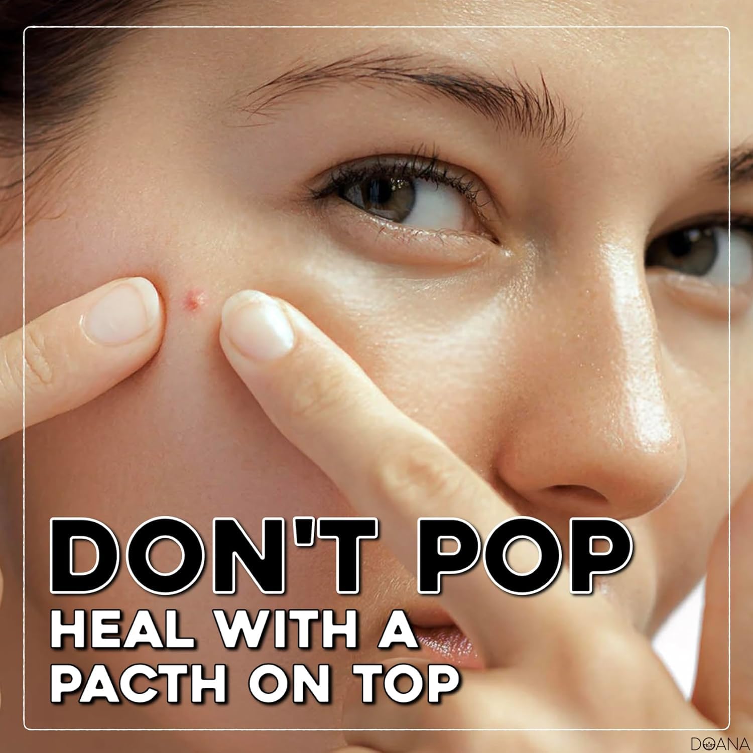 DOANA Korean Pimple Patches - 84 Count / Made in KOREA - Absorbing Hydrocolloid 3 Size Acne Patches for Blemishes. Zits Cover, Spot Stickers for Face and Body, Day and Night, Round Shape