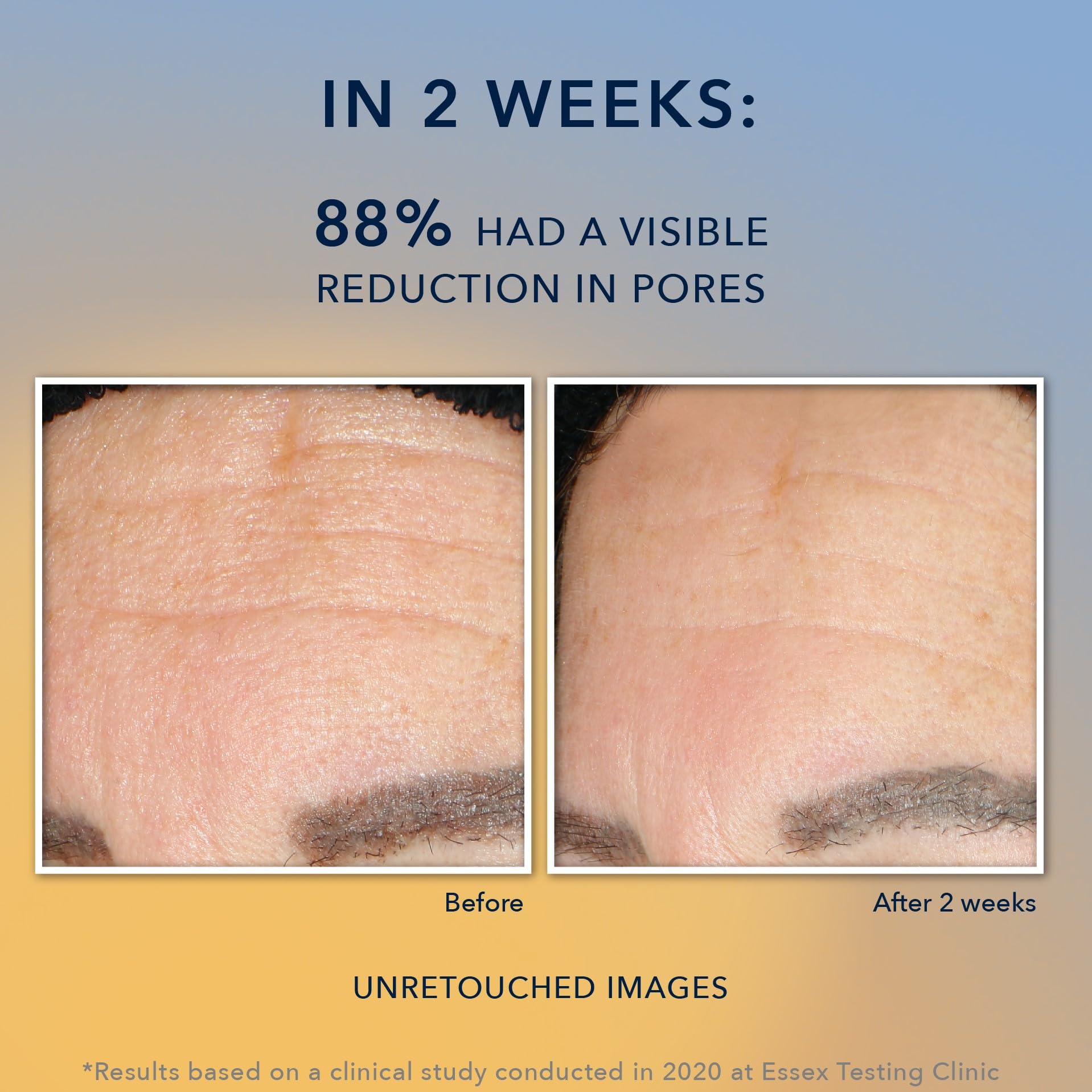 RoC Multi Correxion Revive + Glow Gel Facial Cleanser With Vitamin C, & Glycolic Acid, Paraben-Free, Sulfate-Free Skin Care, 6 Ounces