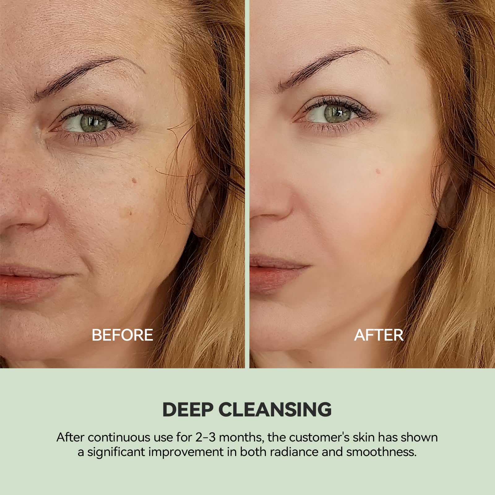 WNP Duo Cleansing Clay Mask with Niacinamide & Hyaluronic Acid – Deep Pore Cleanser for T-Zone & U-Zone, Blackhead Remover, Hydrating & Oil-Control Face Mask, 3.53oz