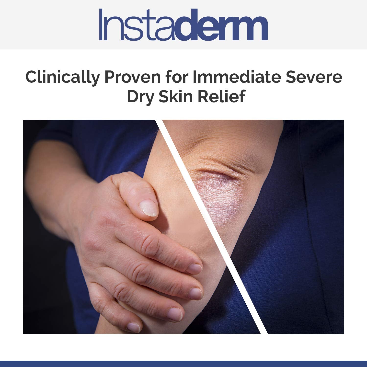 Instaderm Keratosis Pilaris Treatment- KP Bump Eraser. Smoothing Exfoliating Moisturizing Lotion for Rough, Dry, Flakey & Bumpy Skin Conditions with Lactic Acid, AHA. Smooth Skin Body Cream.