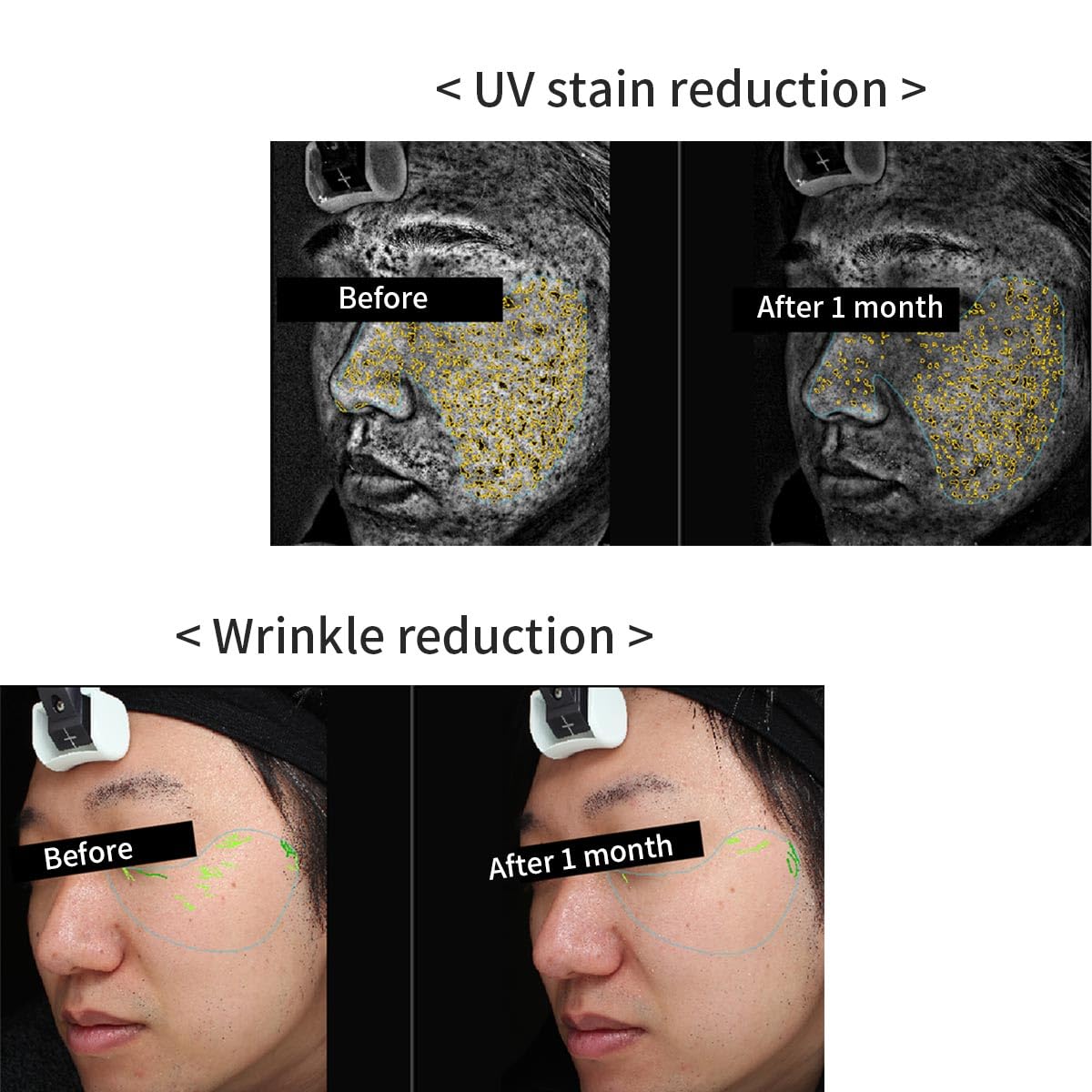 HiCA VC Serum Ethylated Ascorbic Acid 6% Vitamin C Serum 28ml with Niacinamide 2% & Retinol Boost Skin Tightens and Revitalizes