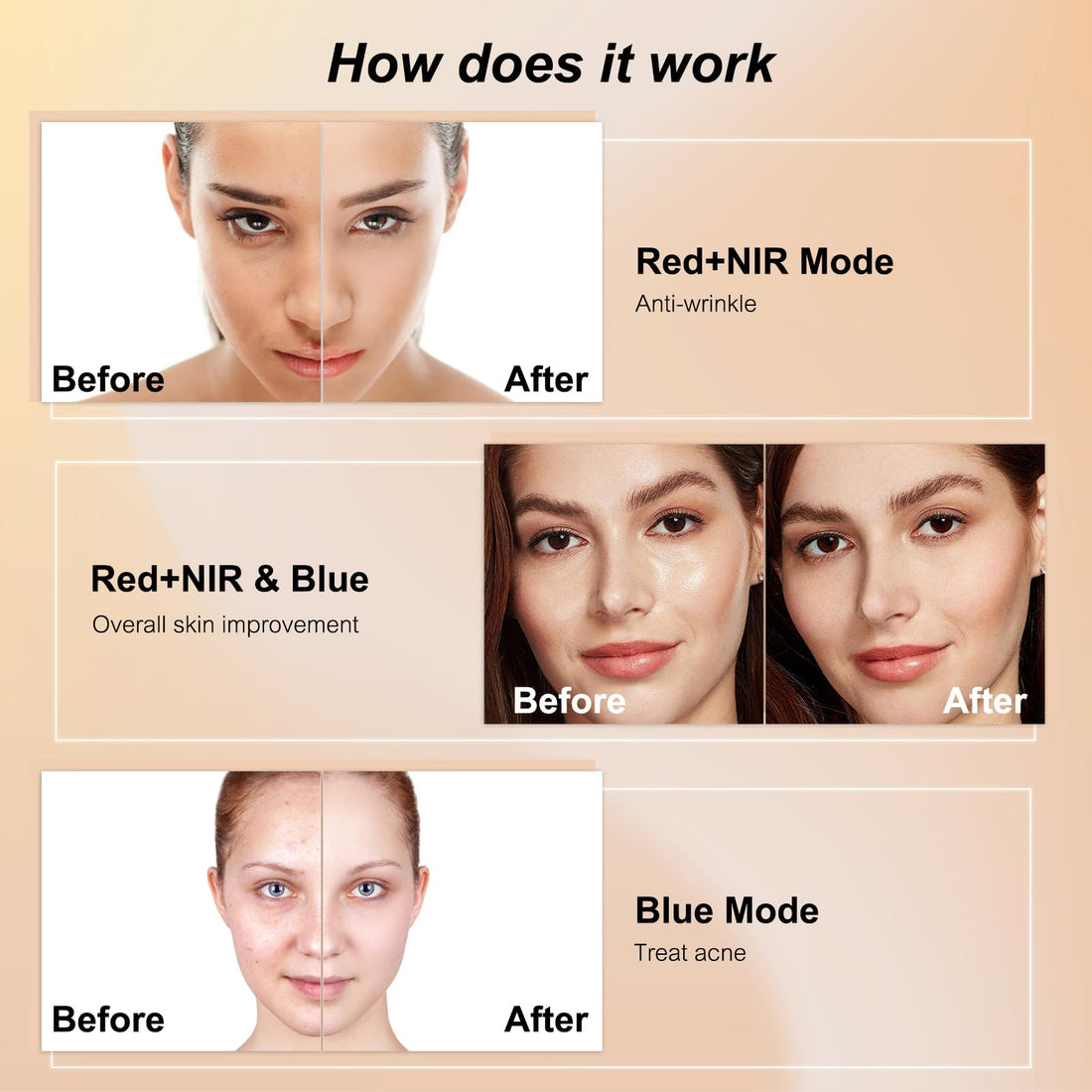 Avorla Beauty LED Light Mask -infrared light therapy red light therapy led facial light Photons Facial Skin Care Wrinkle reduce anti-acne facial light acne treatment beauty device-KFB265