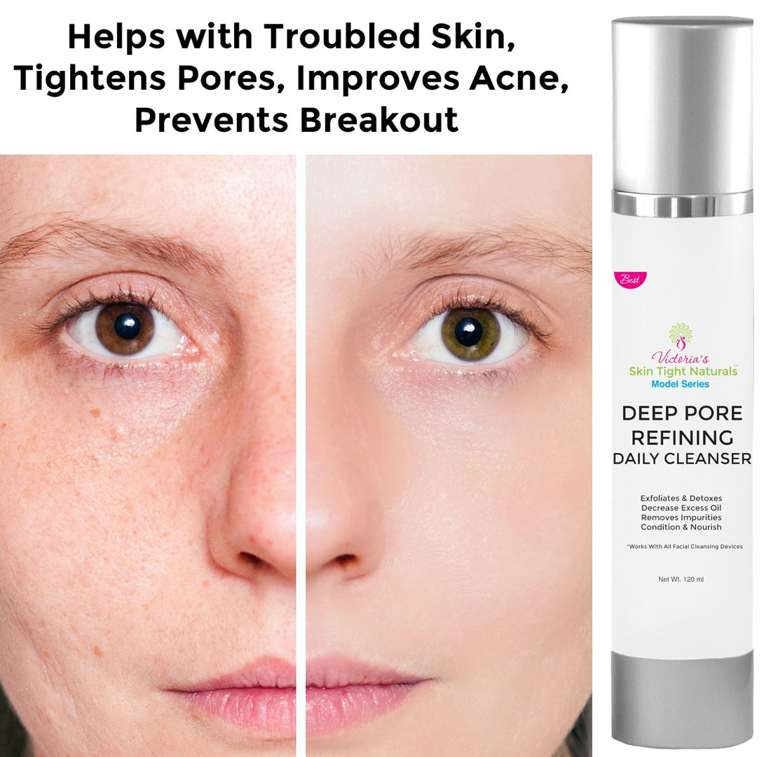 Victoria's Best Deep Cleaning Pore Refining Face Cleanse Anti Aging Skin Care Model Series