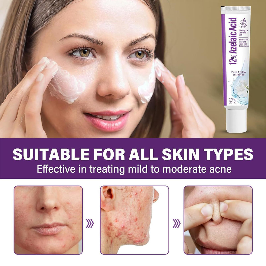 Azelaic Acid 12% Facial Serum with Hyaluronic Acid & Niacinamide, Azelaic Acid Serum for Reducing Blemish & Rosacea Acne, Prevents Acne Breakouts, Ease Pimple Clarify Skin Soothe Irritation