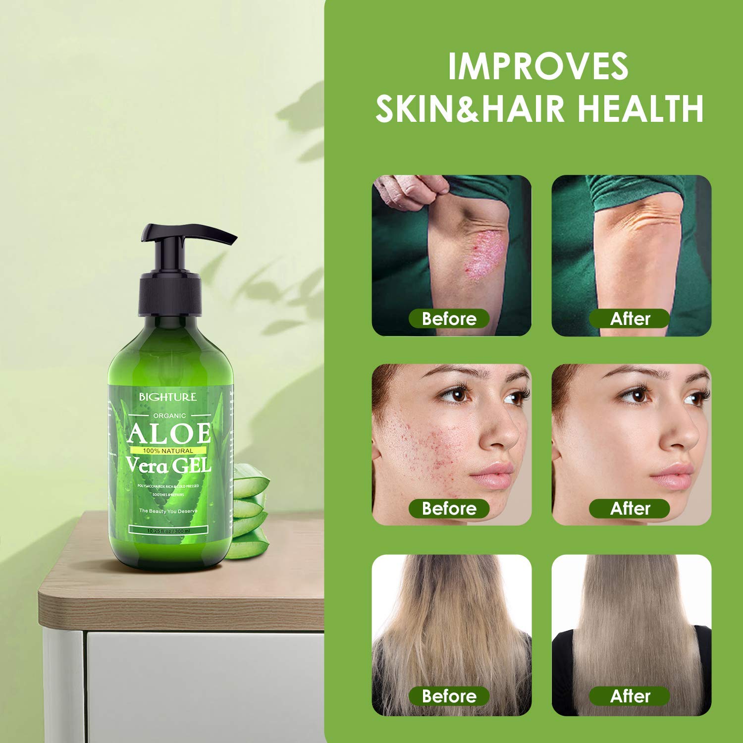 BIGHTURE Aloe Vera Gel, 100% Aloe Vera Organic from Freshly Cut Aloe Leaves, Skin Care for Deeply & Rapidly Soothing, Firming, After Shave, Sunburn Relieve, etc