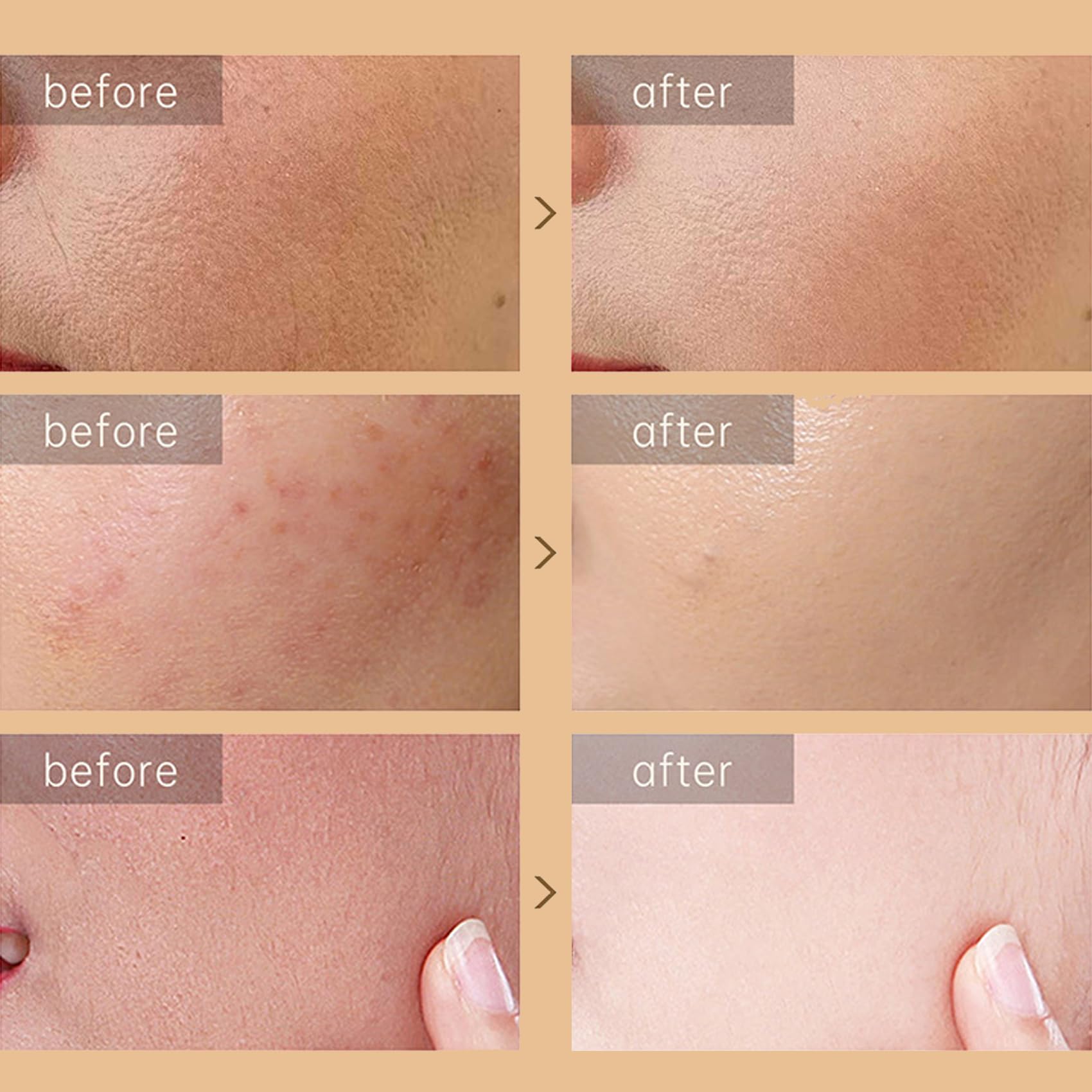 Snail Repair Cream, Snail Moisturizer with Snail Secretion Filtrate, Repair Damage Skin, Ruduce Fine Line, Hydration Snail Face Cream for Dry Skin, Snail Mucin Essence for Women Skin Care