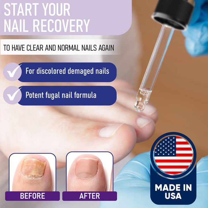 Remove Toenail Fungus Nail Fungus - Strong Toenail Fungus Drops Treatment and Nail Fungus Treatment