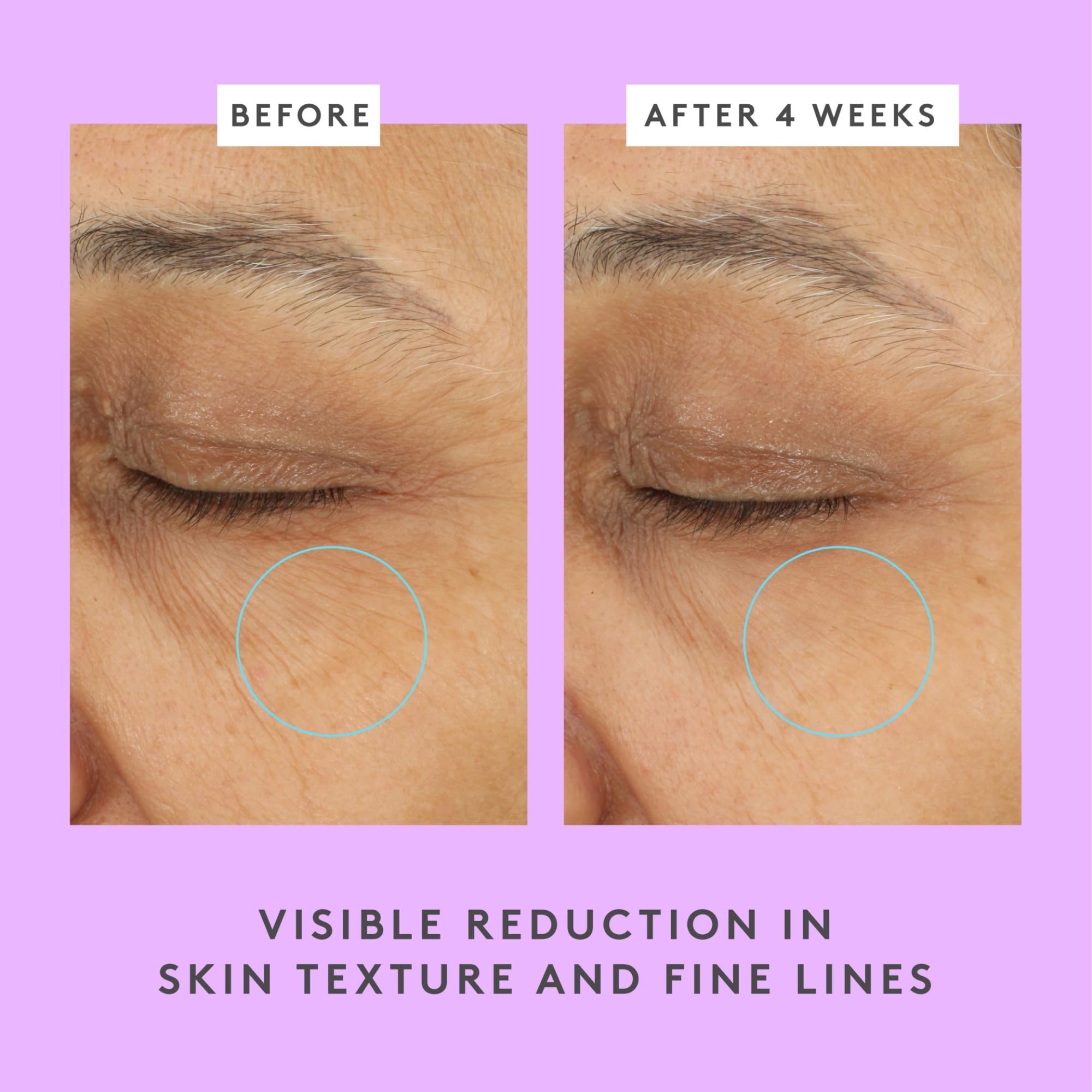 Drunk Elephant Ceramighty AF Eye Balm - 15 ml/.5 fl oz - Moisturizing Eye Cream - Clean Clinical Skincare - Cruelty-Free - Dermatologist-Tested - Free of Essential Oils, Silicones, and Fragrance