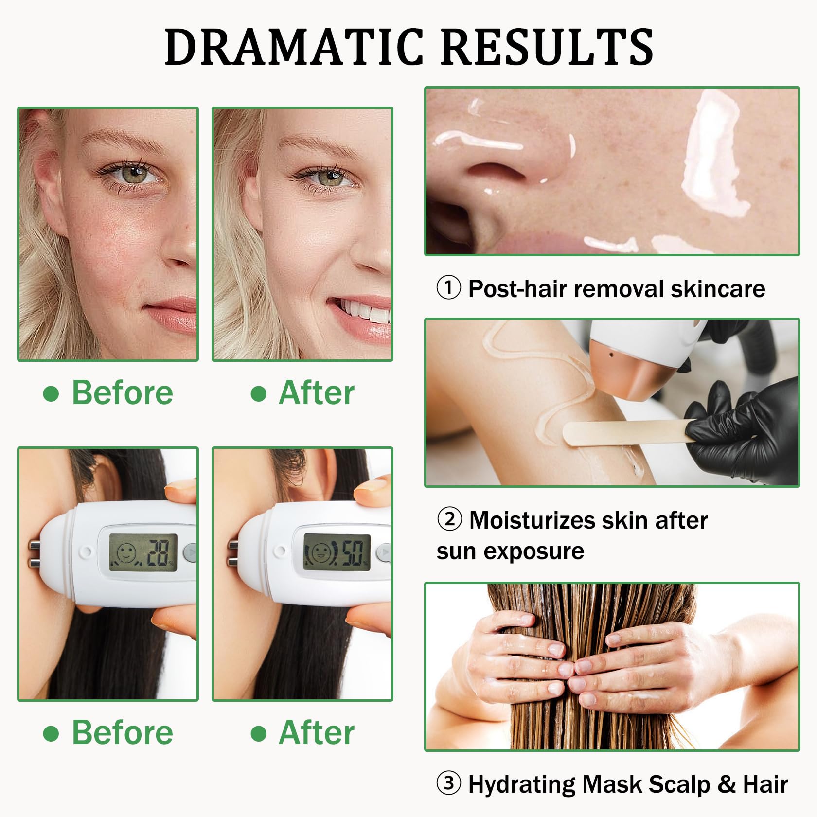 Aloe Vera Gel for Sunburn Relief,Hydrating Travel Size Aloe Vera Gel for Face,Moisturizing Sunburn Relief After Sun Lotion,Fast Absorbing,Non-Sticky Cooling After Sun Lotion Face Moisturizer (F)