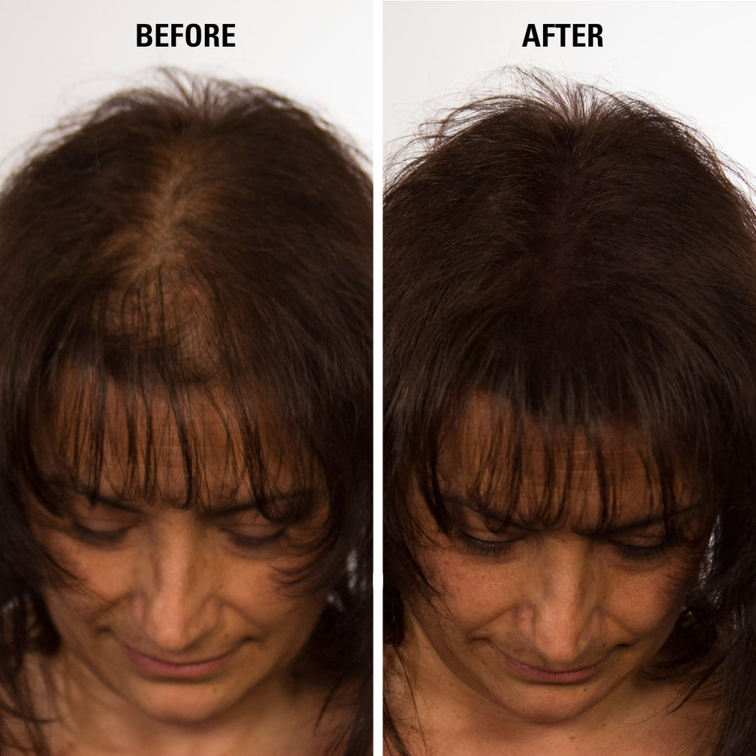 Infinity Hair Fibers for Thinning Hair (WHITE) For Women & Men - 100% Undetectable Fibers - 30g Bottle - Completely Conceals Hair Loss in 15 Seconds