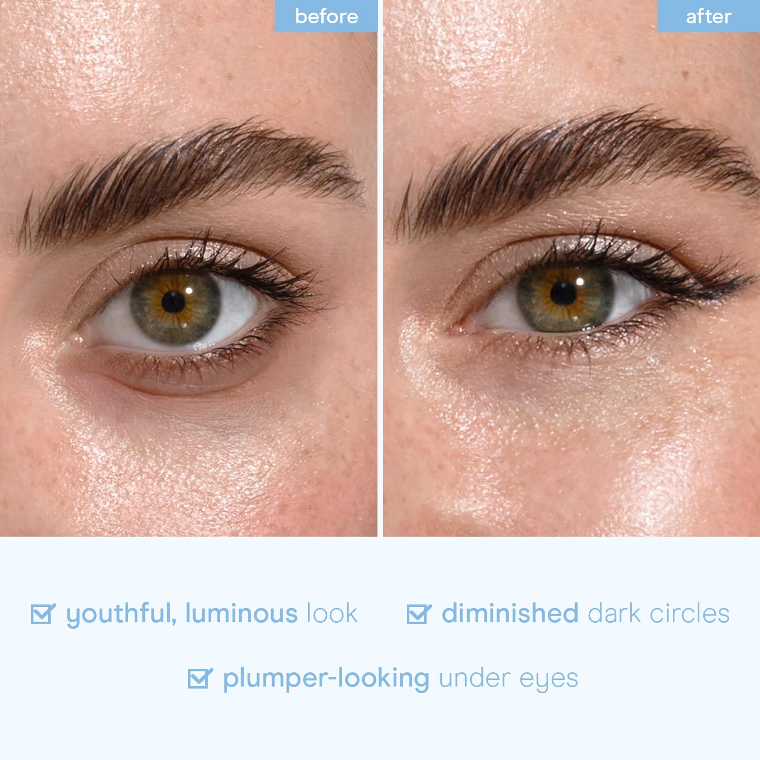 Baebody Advanced Snail Mucin Under Eye Patches for Women & Men (6 Pairs) - Under Eye Masks for Dark Circles and Puffiness - With Niacinamide - Reduce Fine Lines and Wrinkles