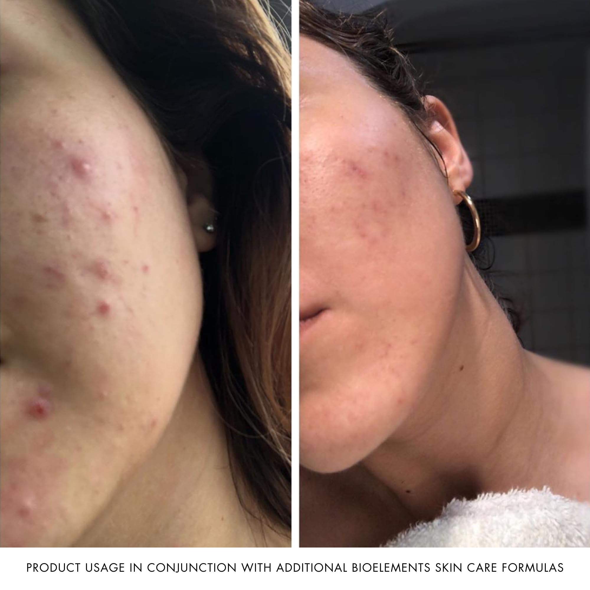 Bioelements Power Peptide, 6-Ounce