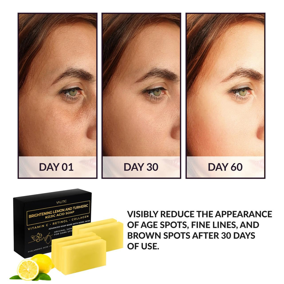 VALITIC Brightening Lemon & Turmeric Kojic Acid Soap with Vitamin C, Retinol, Collagen - Original Japanese Complex Infused with Hyaluronic Acid, Vitamin E, Shea Butter, Castile Olive Oil (5 Pack)