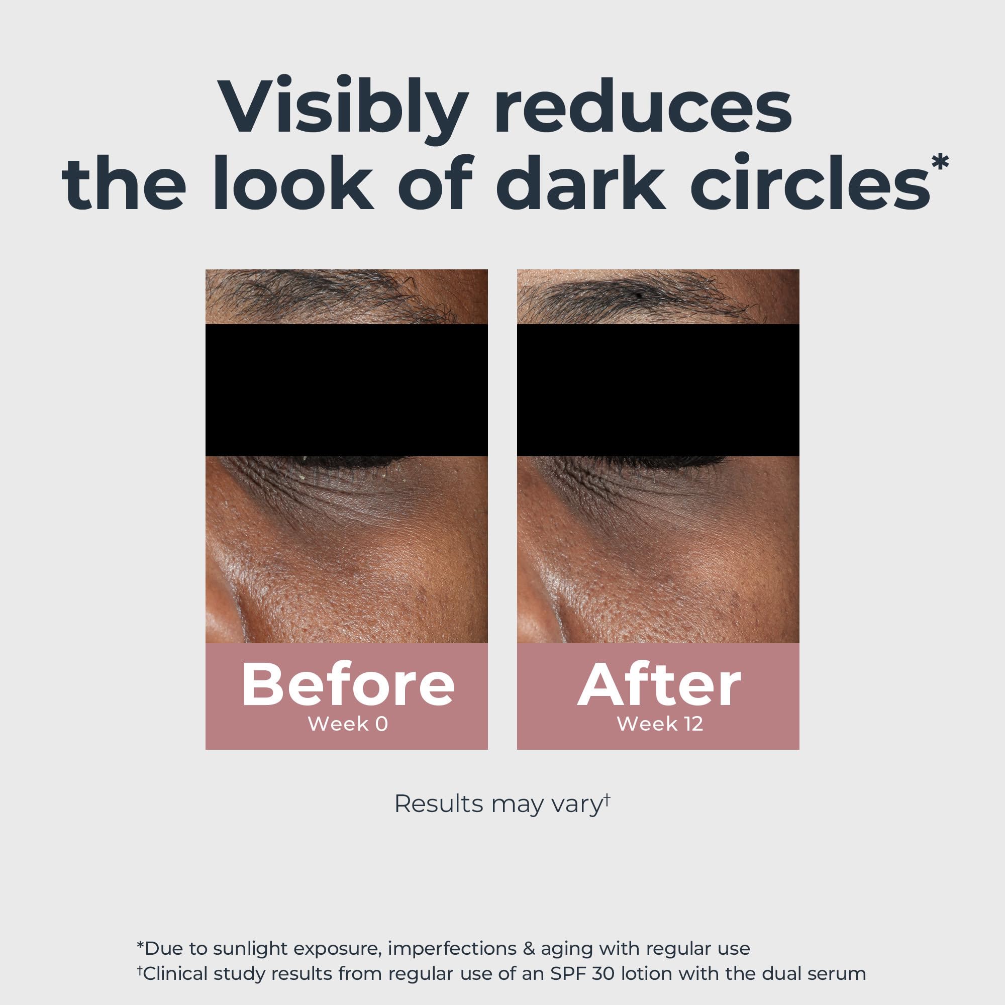 Eucerin Radiant Tone Eye Cream Dark Circle Corrector, Eye Brightening Cream with Thiamidol and Hyaluronic Acid, Helps Reduce the Look of Eye Puffiness, 0.5 Oz Tube