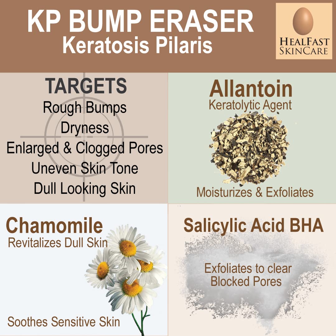 HealFast KP Bump Eraser Cream 4 Oz – Soften, Nourish Rough and Bumpy Skin with 2% BHA – Keratosis Pilaris - For All Types – No Scrubbing Required – Fragrance and Paraben Free