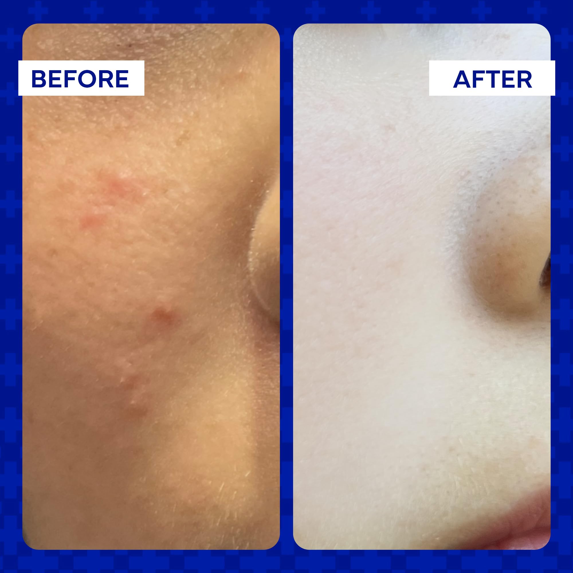 emuaid Clear + Repair Hypochlorous Acid Skin Spray, Hydrating Face and Mist Protection, Multi-Use Care for Sensitive Skin, Travel Size, 1 Pack