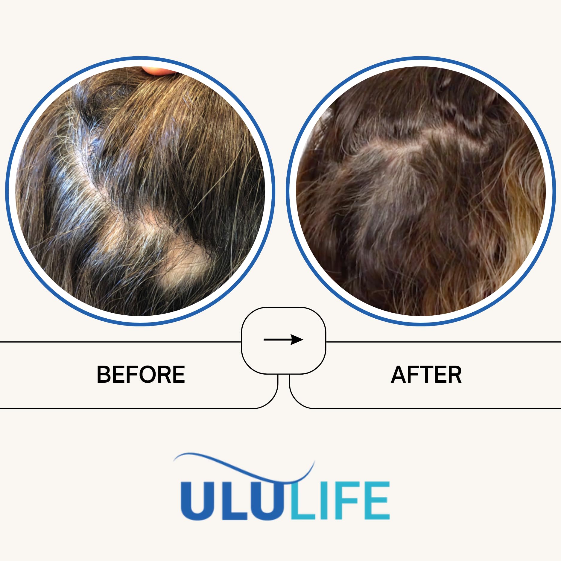 ULULIFE Ultimate Regrow Multivitamin: Promotes Hair Growth, Skin, & Nails Health - Ashwagandha & Resveratrol-Powered Solution for Hormone Support & Overall Health - 180 Capsules (30-Day Supply)