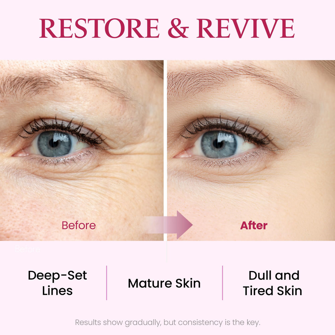 MAXCLINIC Collagen Intensive Ampoule | Firming Face Serum w/ 3 Types of Collagen | Hydrating Face Serum Ampoule Korean Skin Care | Glass Skin Ampoule (3.38 fl oz)