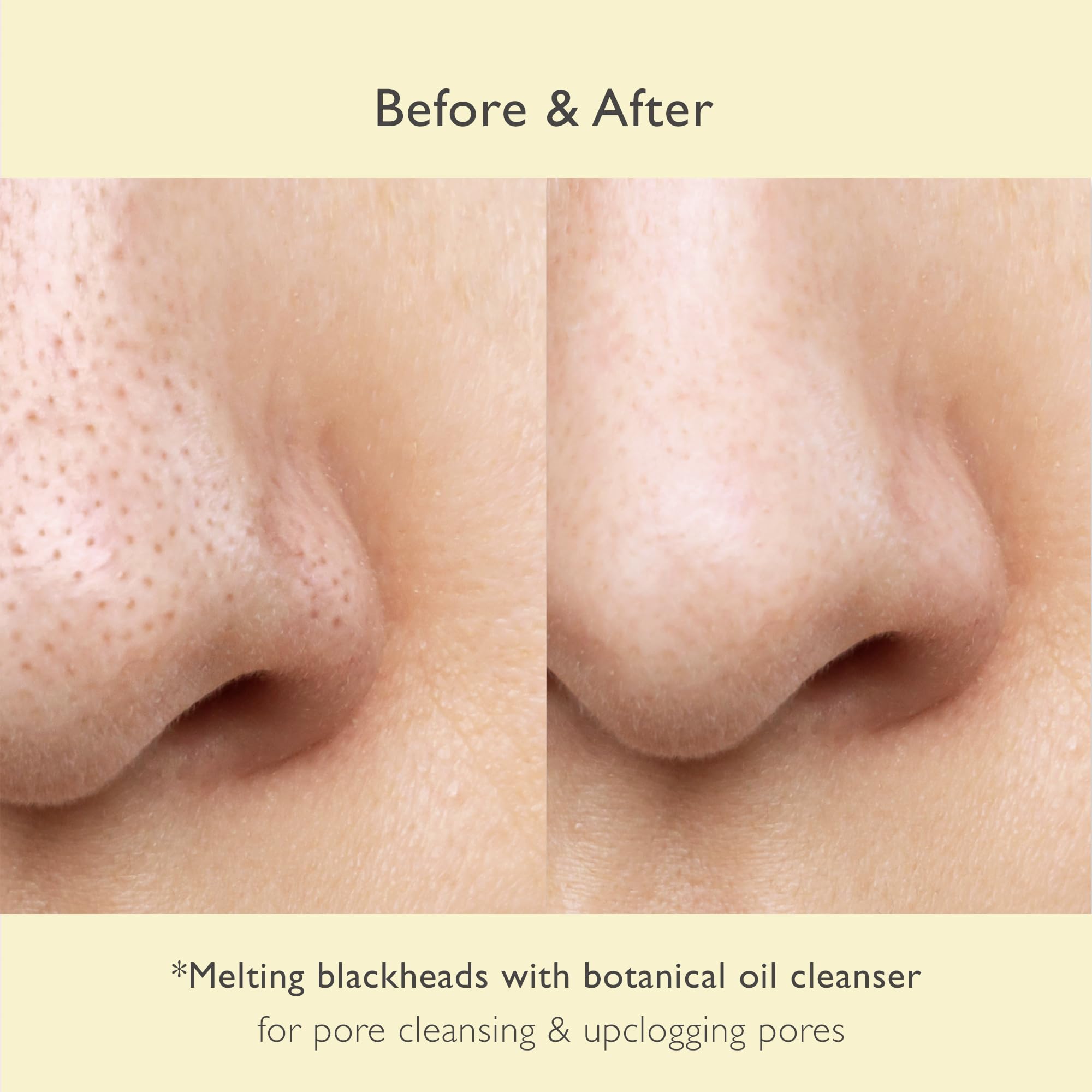 NOWATER No Pore Cleansing Oil | Makeup Cleansing Oil | Pore Cleansing, Blackheads Removal | Olive Oil, Tea Tree, Squalane | Korean Skin Care for face (6.76 fl.oz)