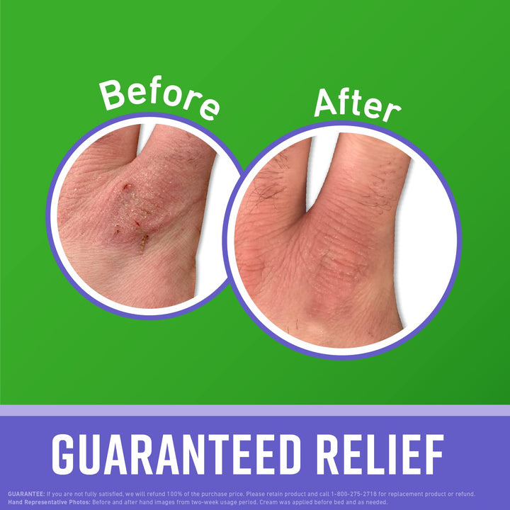 O'Keeffe's Working Hands Night Treatment Hand Cream for Extreme Dryness - 7 oz Tube (1 Pack) - Repairing Skincare for Cracked, Dry Hands