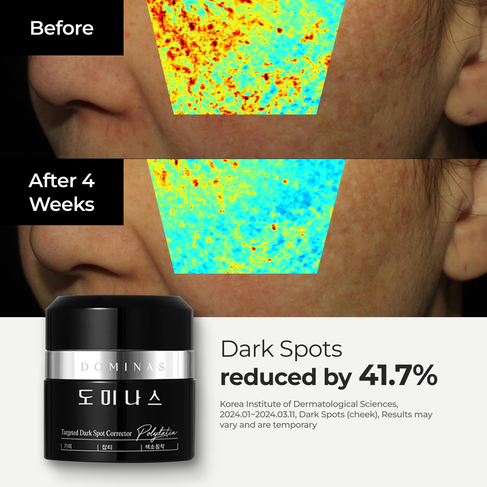 DOMINAS Cream - Advanced Korean Cream for Even Skin Tone and Skin Elasticity Niacinamide, Panthenol, Urea, Trehalose & TECA (1.76oz)