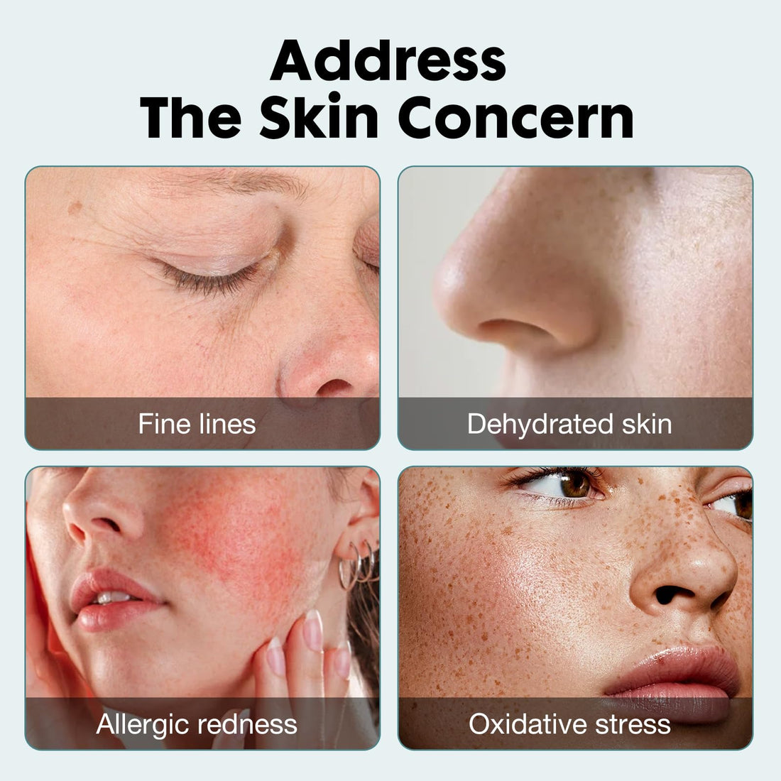 DERMASOF Olive Facial Serum Helps Redness Relieve.This Anti Aging Serum contains Hyaluronic Acid,Matrixyl 3000,and Peptides.Hydrating,Calming,and Repairing your skin.Made in USA;1 Fl Oz (30ml)