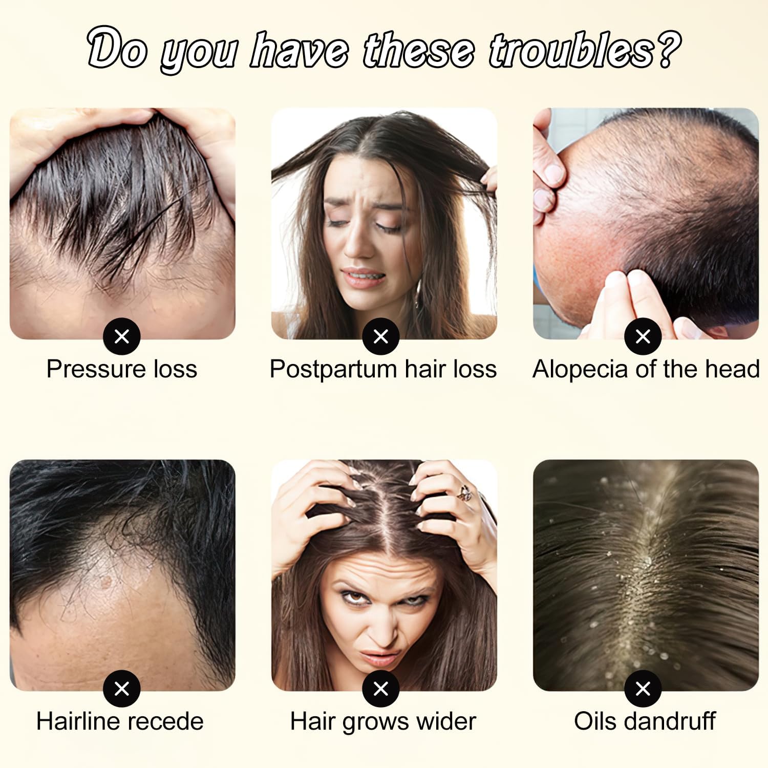 YCNASSS Ginger Plant Extract Shampoo for Hair Growth, Anti-Dandruff and Oil Control with Polygonum Multiflorum