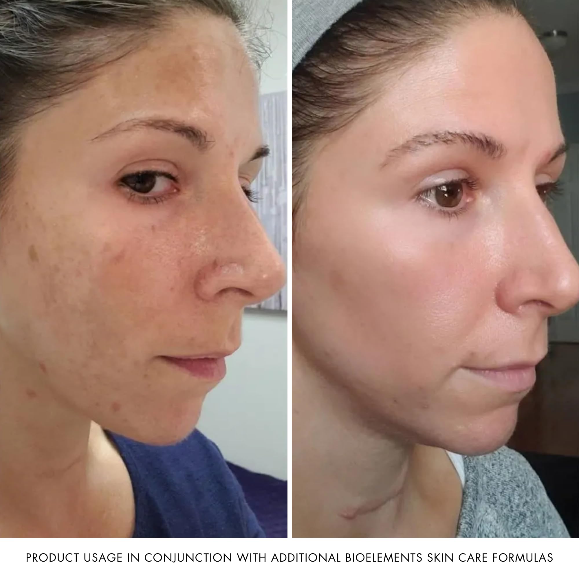 Bioelements Absolute Moisture, 2.5-Ounce