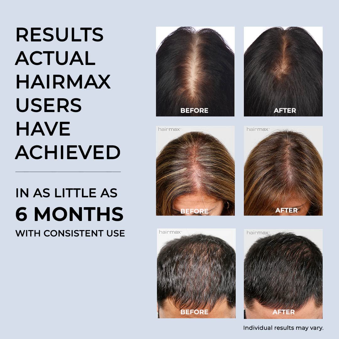 Hairmax Laser band41