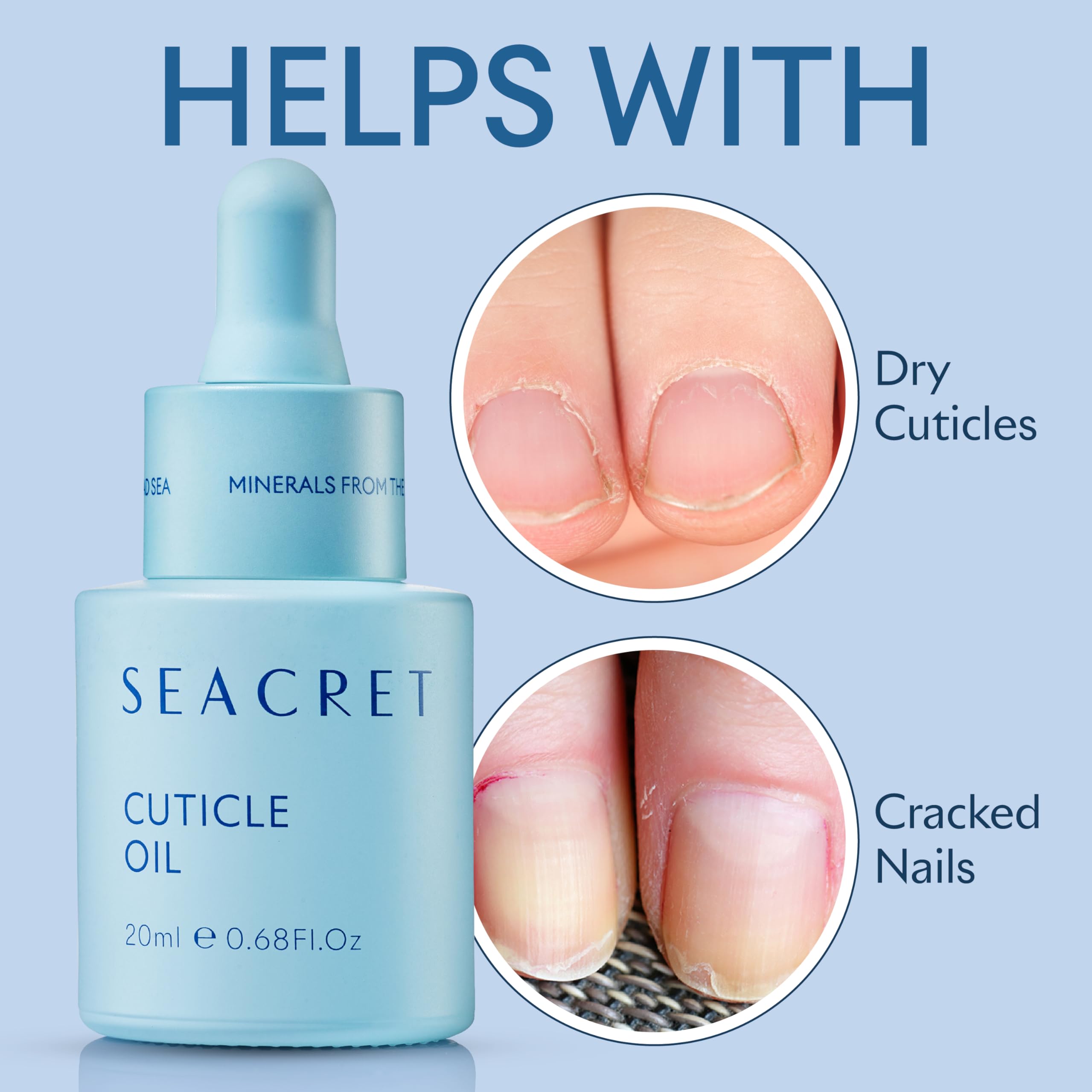 SEACRET NAIL CARE COLLECTION: Dead Sea Mineral Fingernail & Toenail DIY Salon Manicure Treatment Set with File, 3-Way Buffer Block for Shine, 1 Oz Cuticle Oil, & 6.8 Oz Body Lotion Kit, All Skin Types