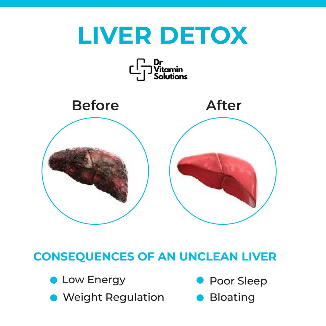 DR VITAMIN SOLUTIONS Liver Cleanse Detox and Repair - Milk Thistle Supplement with Chlorophyll, Digestive Enzymes, Artichoke & Dandelion for Natural Gallbladder Support, 30 Vegan Capsules