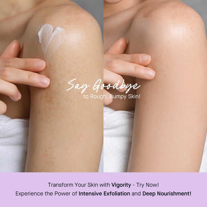 Vigority KP Bump Eraser for Keratosis Pilaris: Body Moisturizer Exfoliating Cream - KP Bump Be Gone Treatment for Bumpy Dry Rough Skin