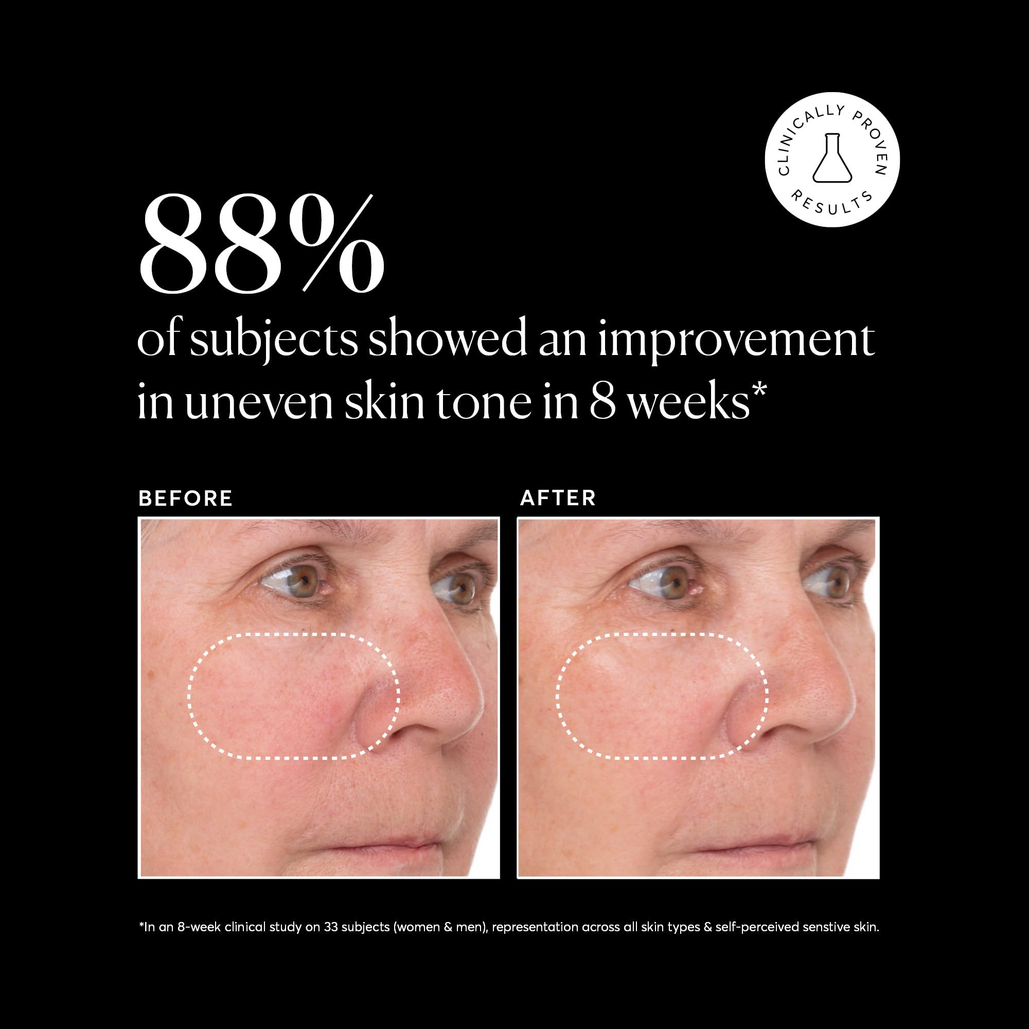 Naturium Vitamin C Super Serum Plus Jumbo, Smoothing Face Care, plus Retinol, Hyaluronic Acid, Niacinamide & Salicylic Acid, 2 oz