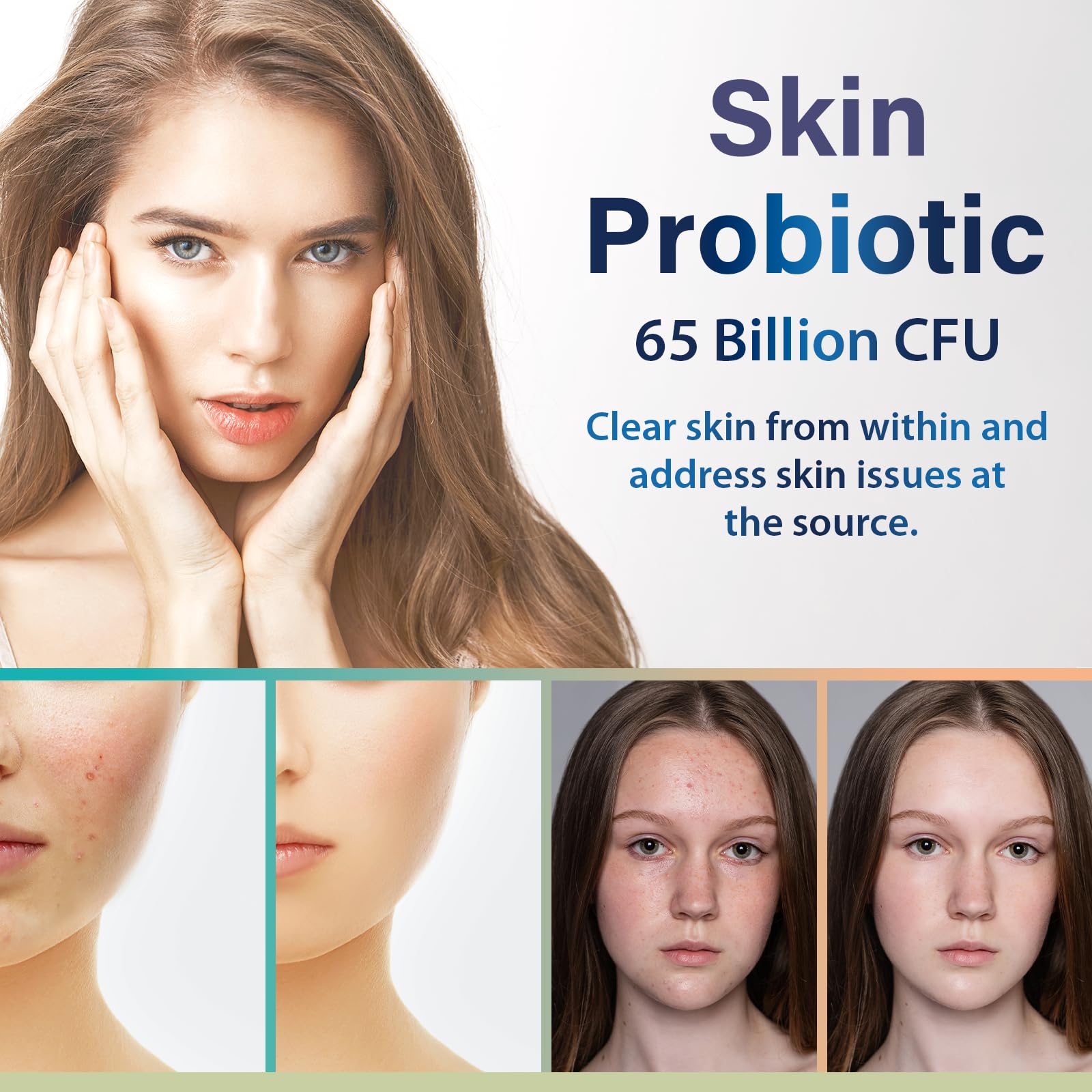 Beauty Probiotics for Women, Collagen Boost with 3-in-1 Complete Prebiotics, Postbiotics & Probiotics for Hair, Skin, Nails & Vaginal Health - 65 Billion CFU, Ceramides, Resveratrol & CoQ10, 60 Caps