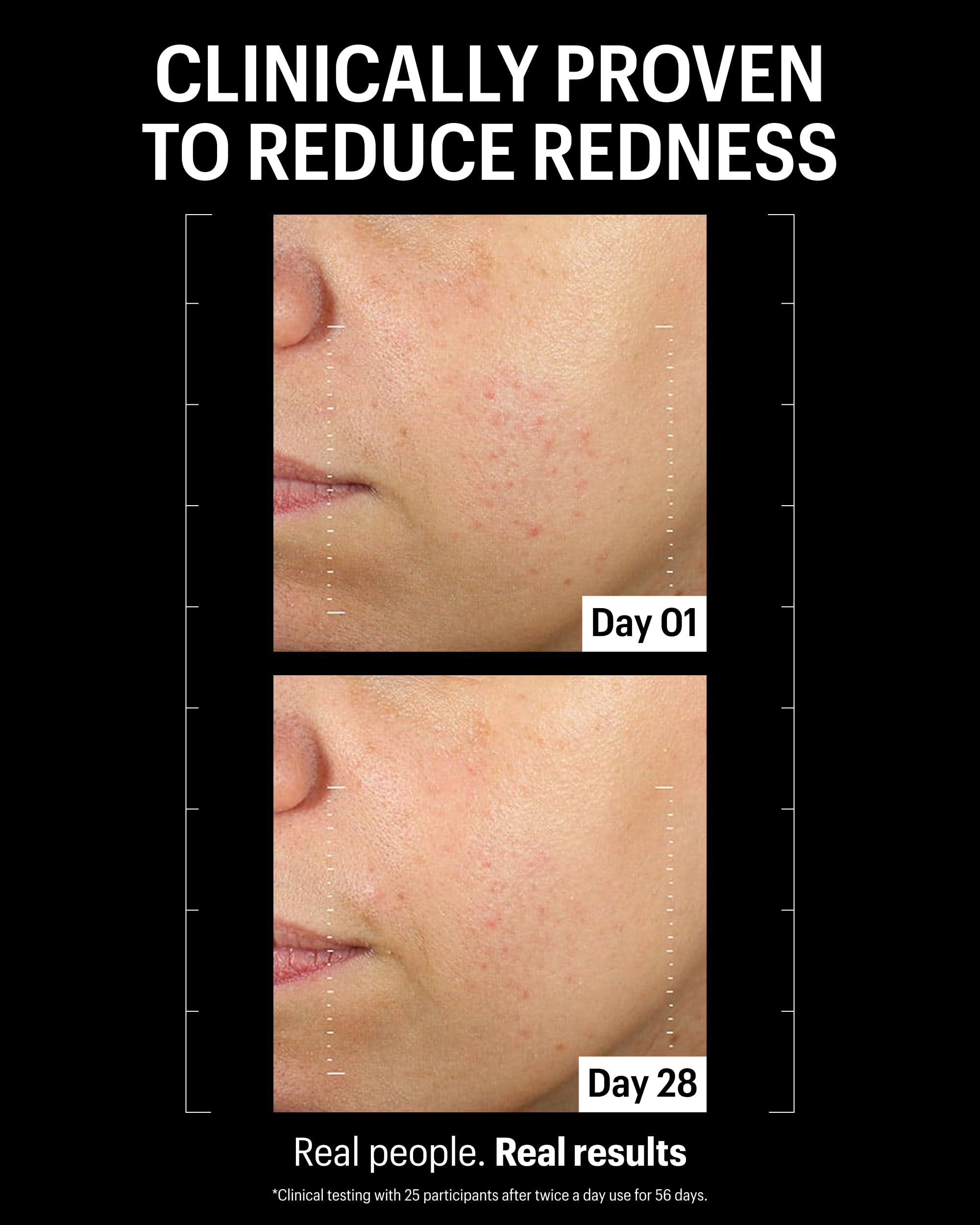 Allies of Skin Retinal 0.1% Peptides Repair Night Cream with 0.1% Encapsulated Retinal, 6 Peptides, 2% Ornithine & EGCG Complex, 8.7% Ceramides & Omegas Complex