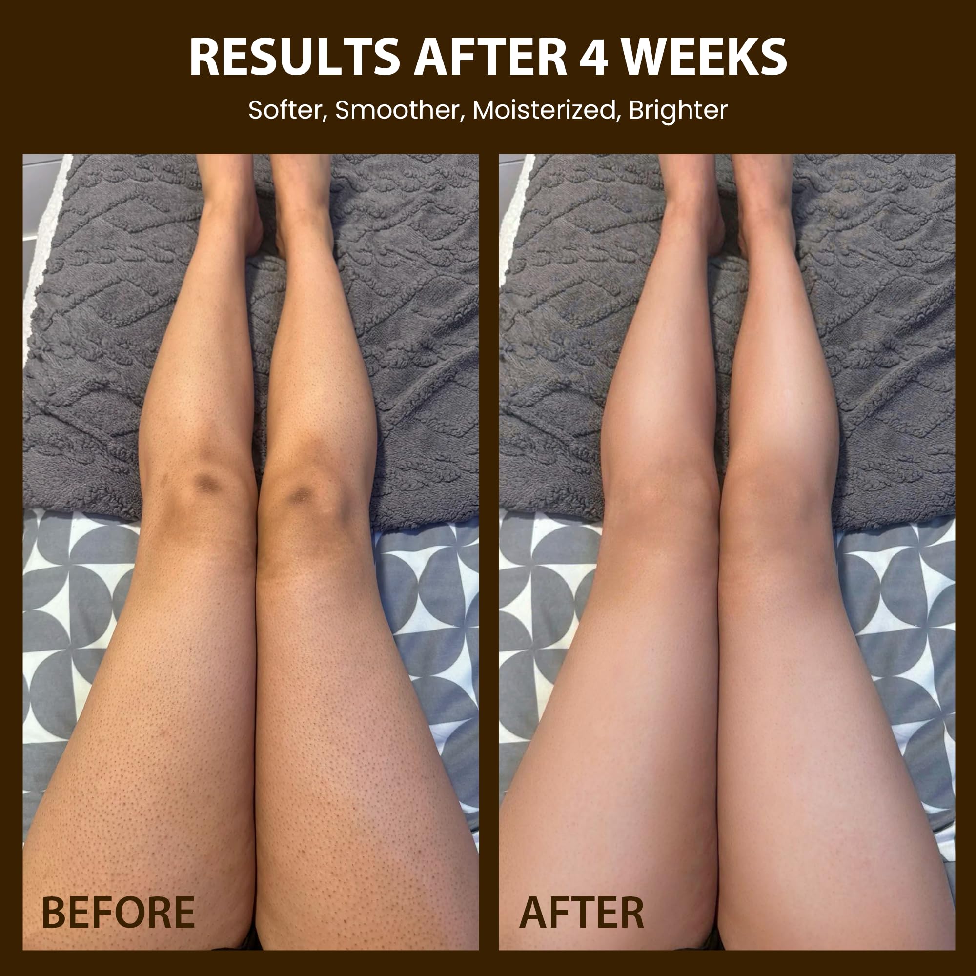 Brewblossom Organic Robusta Coffee Body Scrub 8 oz with Coconut Oil & Shea Butter - Moisturizing and Exfoliating Body, Face, Hand, Foot Scrub - Cellulite, Fight Stretch Mark, Fine Line, Wrinkle