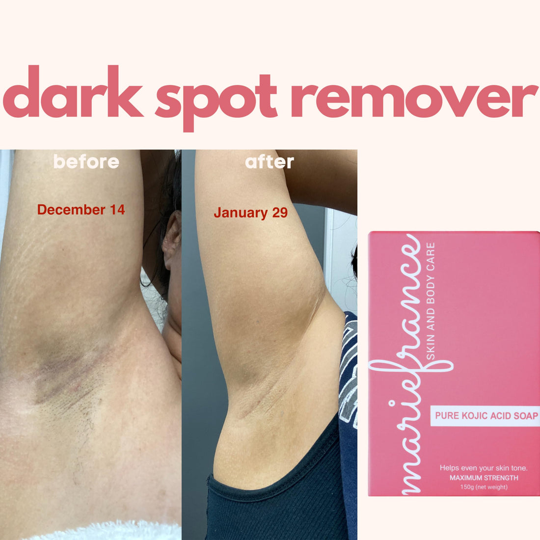 Pure Kojic Acid Soap for Hyperpigmentation, Dark Spots & Skin Brightening with Papaya Extract, Vitamin C & E - Maximum Strength, Fragrance-free, 5.3 oz