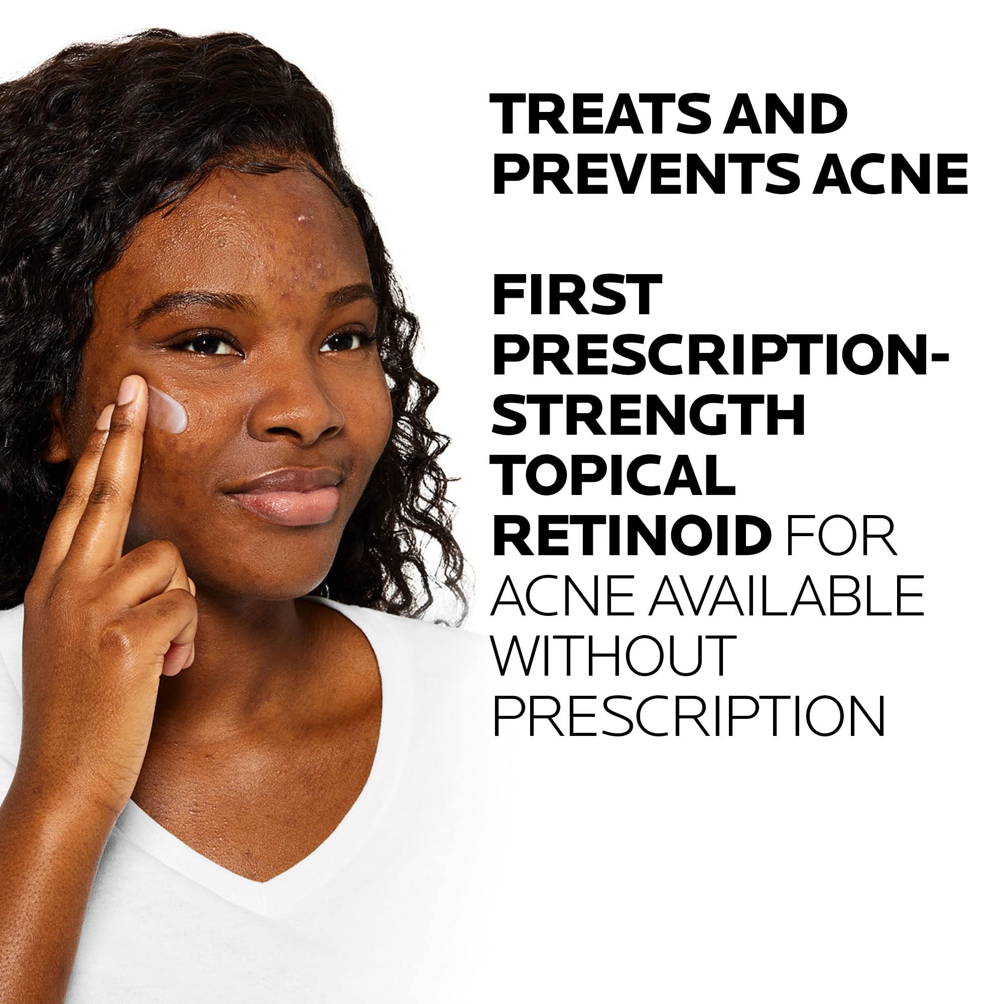 La Roche-Posay Effaclar Adapalene Gel 0.1% Acne Treatment, Retinoid Cream, Acne Medication Gel For Blackheads & Whiteheads, Oil Free, Helps Clear And Prevent Blemishes & Clogged Pores