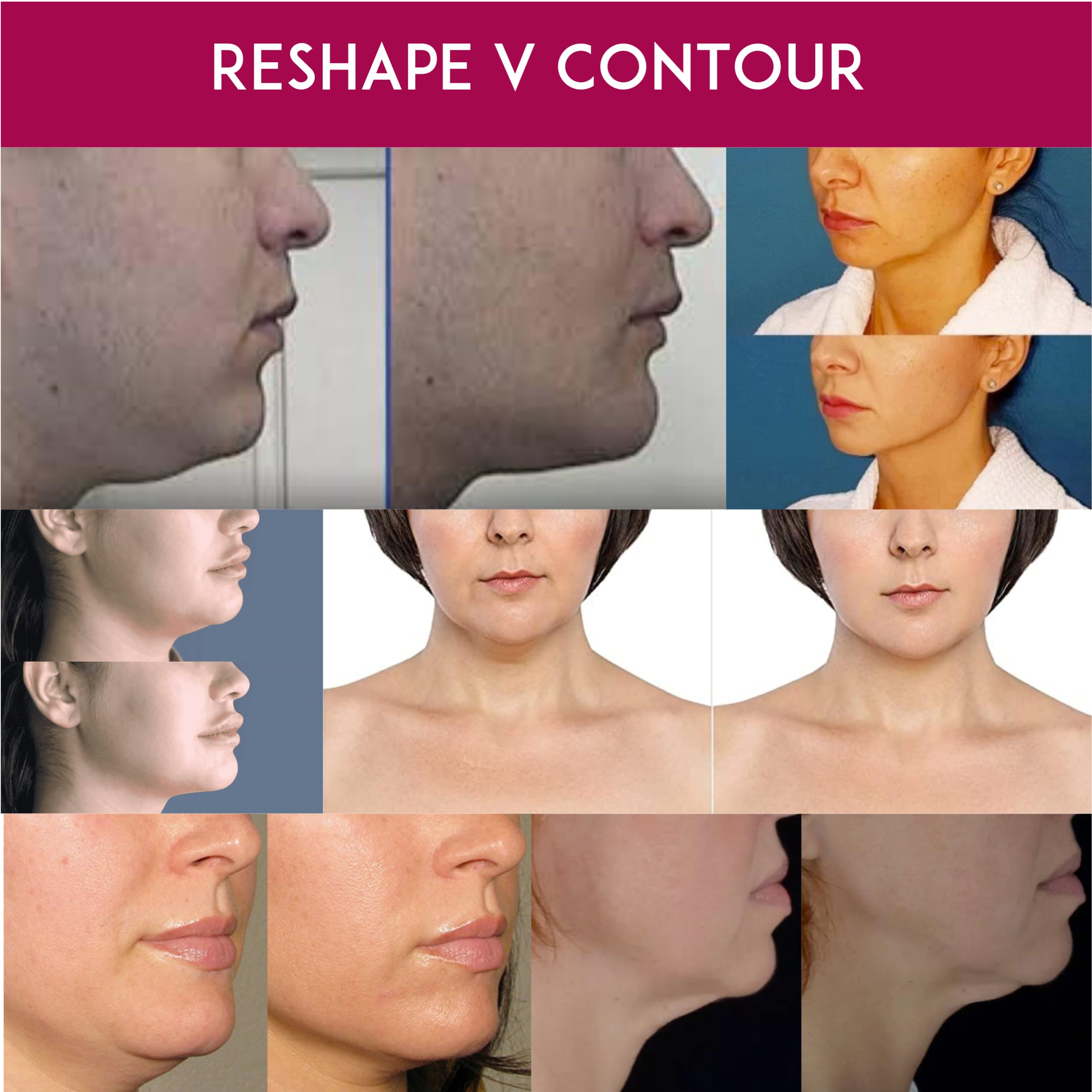 Anacis Advanced Neck Cream - Neck Chin & Jawline Sculpting - Fine Lines - Neck Wrinkles - Sagging Skin - Anti Aging Cream for Women and Men 30 ml