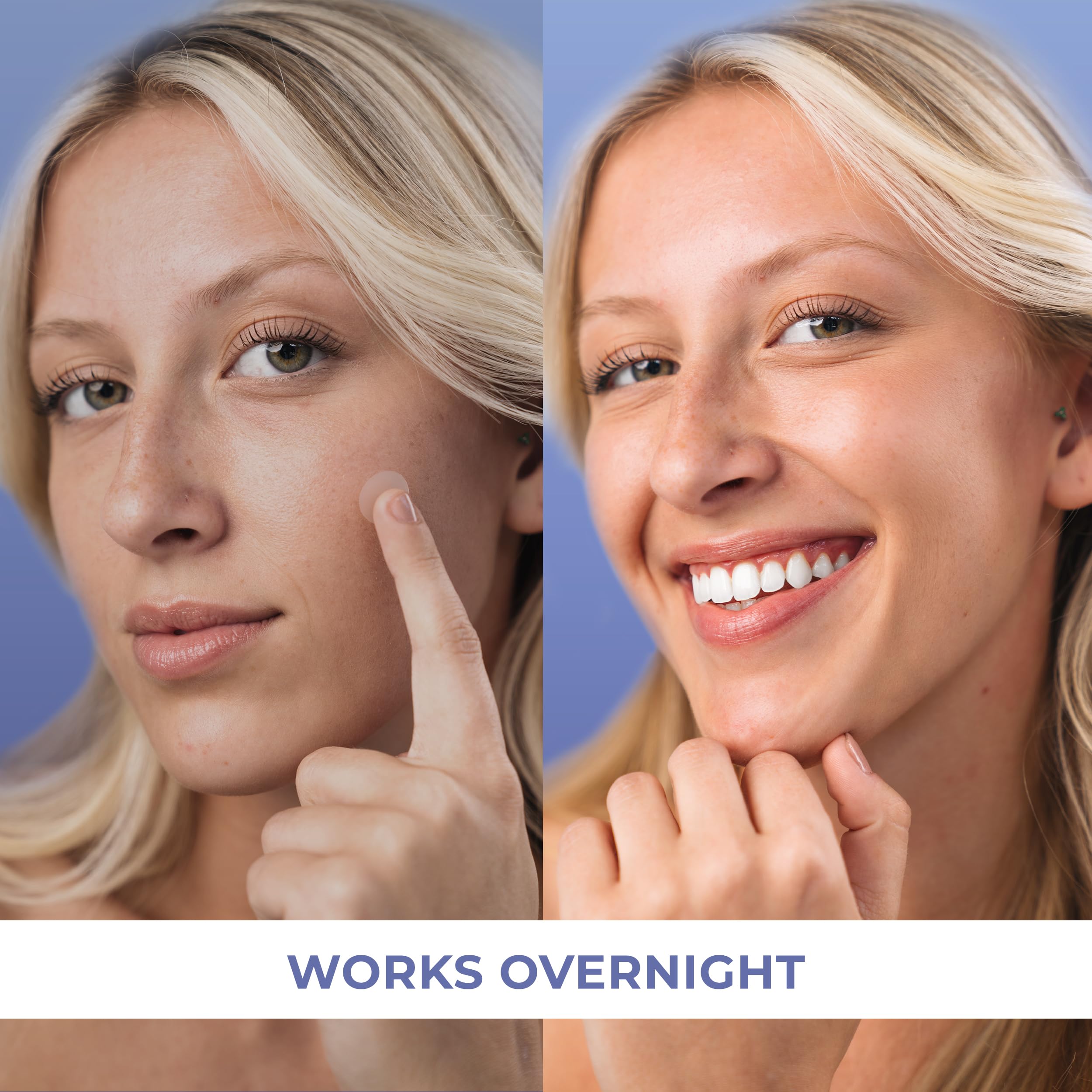 PatchRx Salicylic Pimple Patches (120 Pack), Salicylic Acid Acne Patches with Tea Tree Oil - Zit Patch and Pimple Stickers for Face for Skin Care - Salicylic Acid Acne Dots (Packaging May Vary)