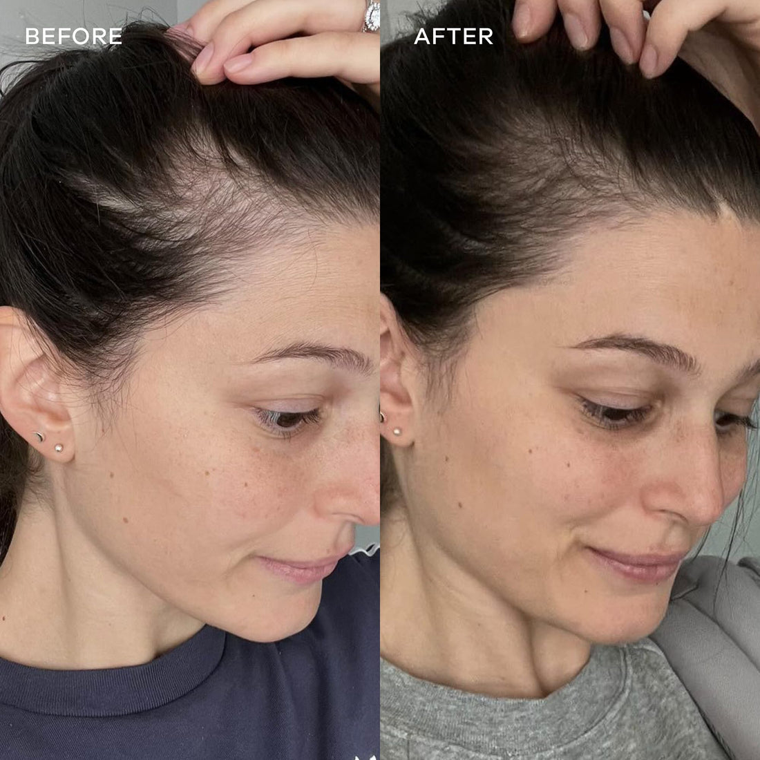 Vida Glow Marine Collagen Powder - Anti Aging Supplement with Collagen Peptides, Promotes Glowing Skin, Strong Nails, Healthy Hair | 30 Servings, Original Flavor