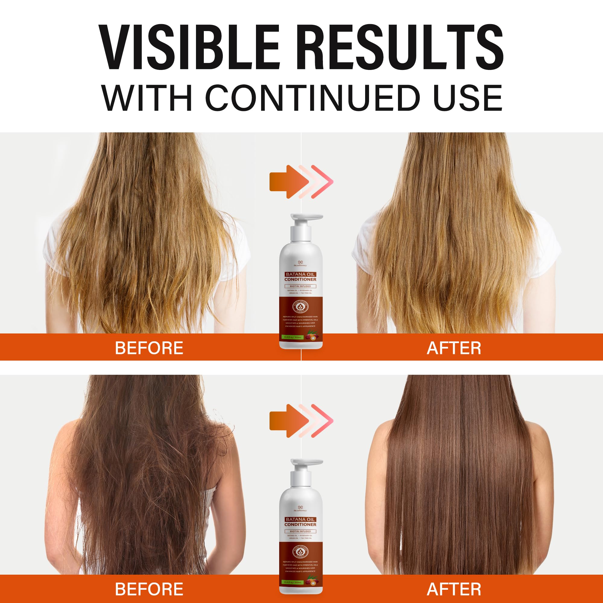 Batana Oil Hair Growth Conditioner: Natural Hair Thickening Moisturizing Product for Thinning Hair for Women and Men - Daily Hair Care at Home - 11.8 fl.oz