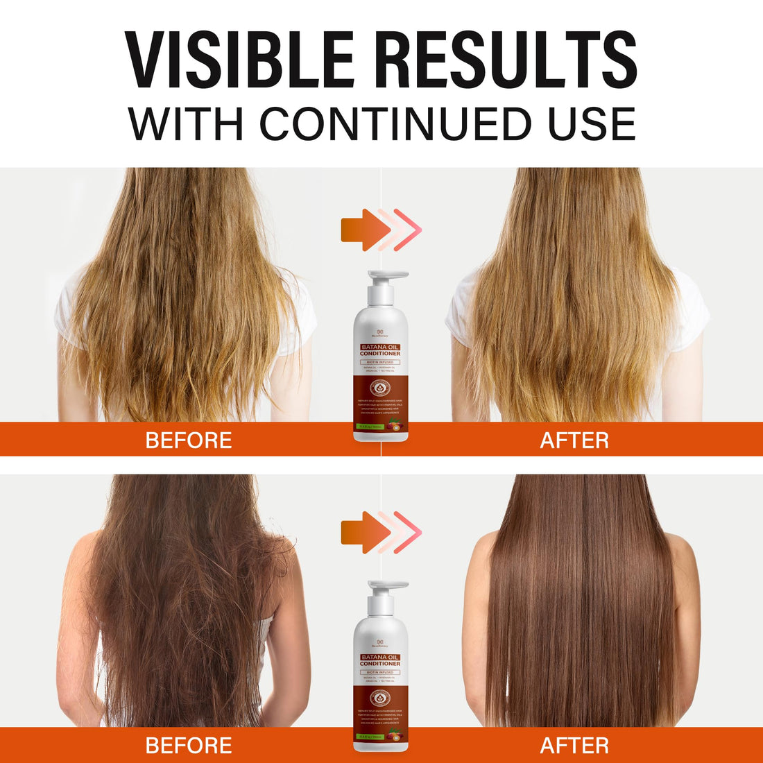 Batana Oil Hair Growth Conditioner: Natural Hair Thickening Moisturizing Product for Thinning Hair for Women and Men - Daily Hair Care at Home - 11.8 fl.oz